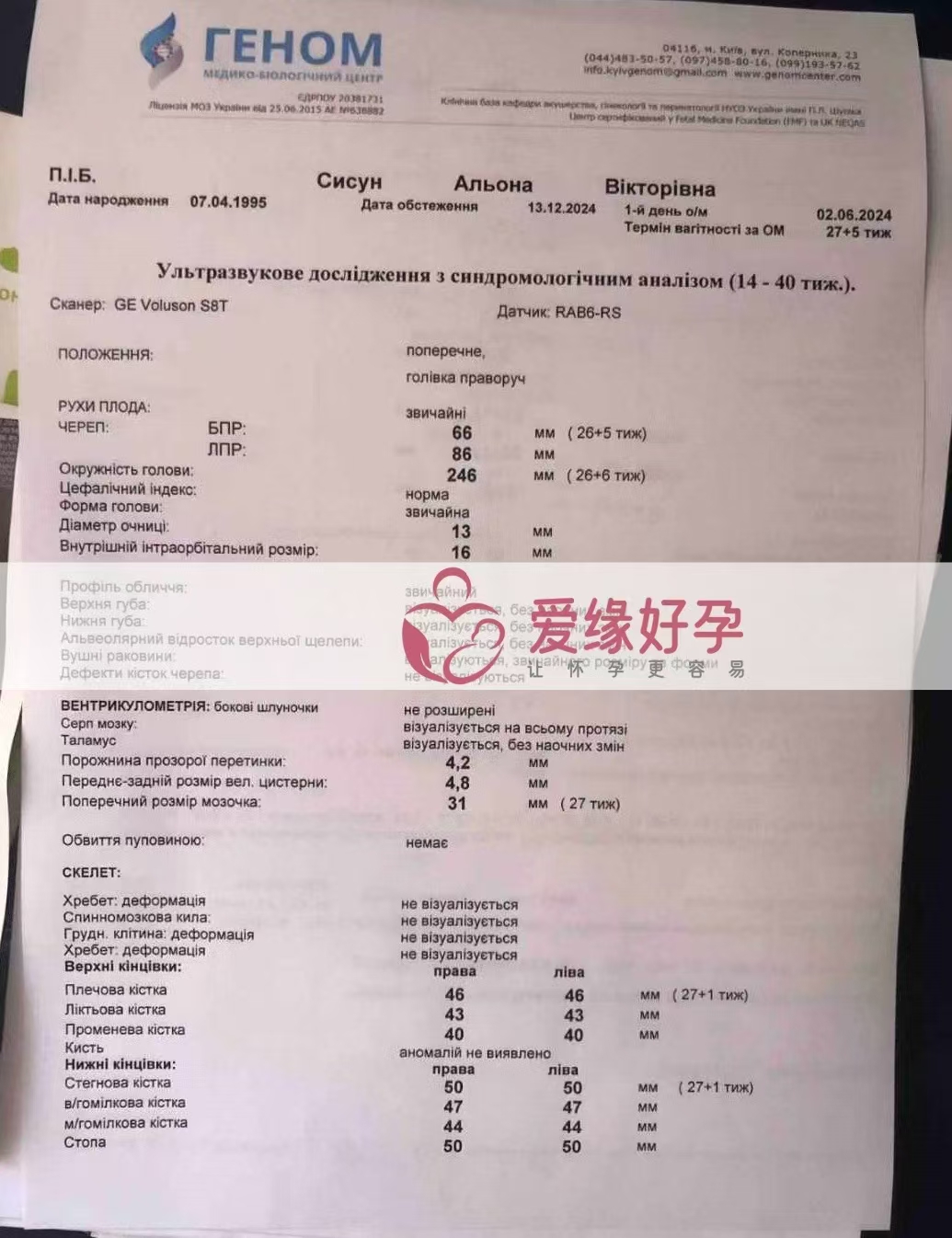 乌克兰代孕代母孕26周大排畸产检顺利通过