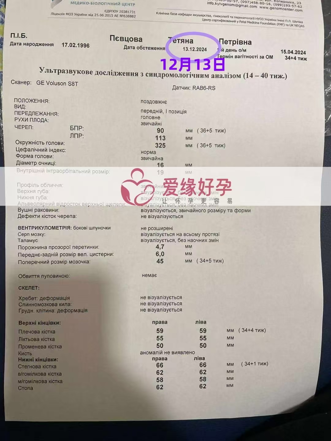 乌克兰代孕代母孕34周产检顺利通过