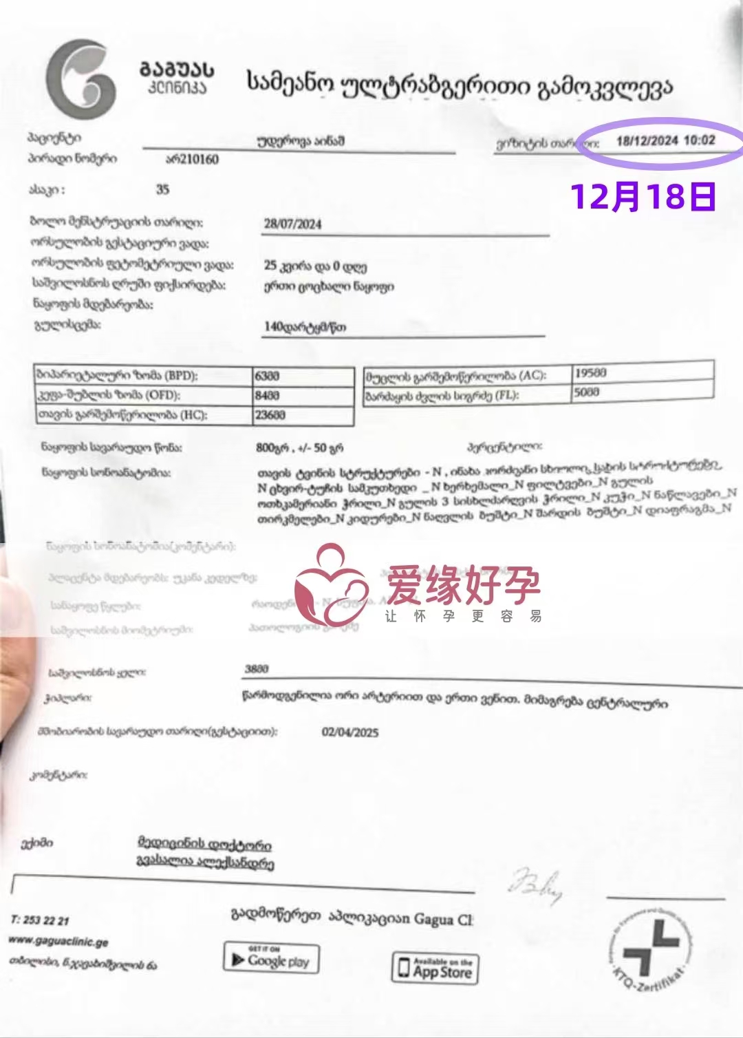 格鲁吉亚代孕代母孕25周产检顺利通过
