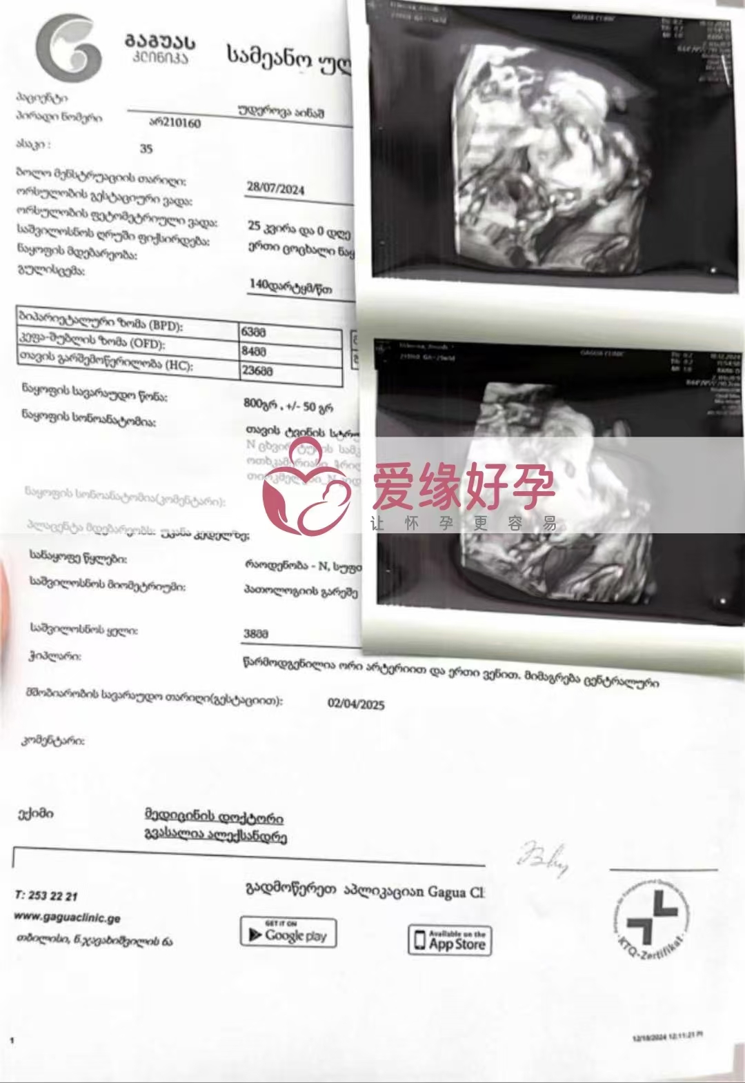 格鲁吉亚代孕代母孕25周产检顺利通过