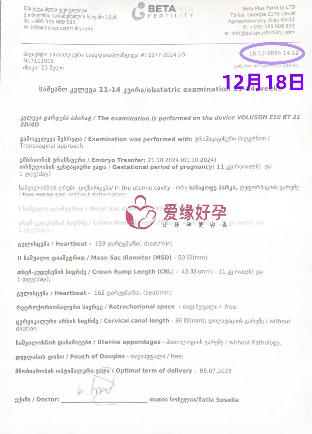 格鲁吉亚代孕代母孕11周产检顺利通过