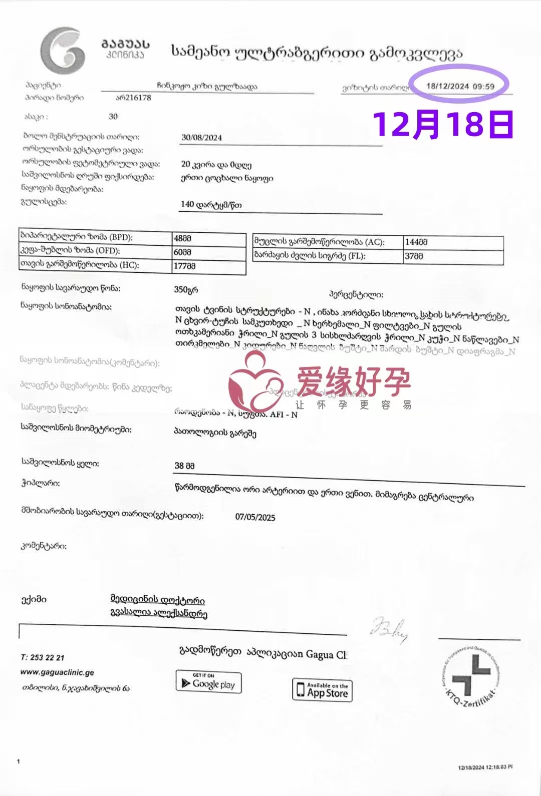 格鲁吉亚代孕代母孕20周产检顺利通过