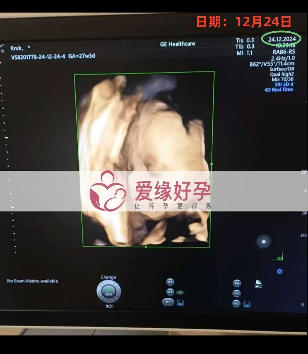 乌克兰代孕代母孕27周产检顺利通过