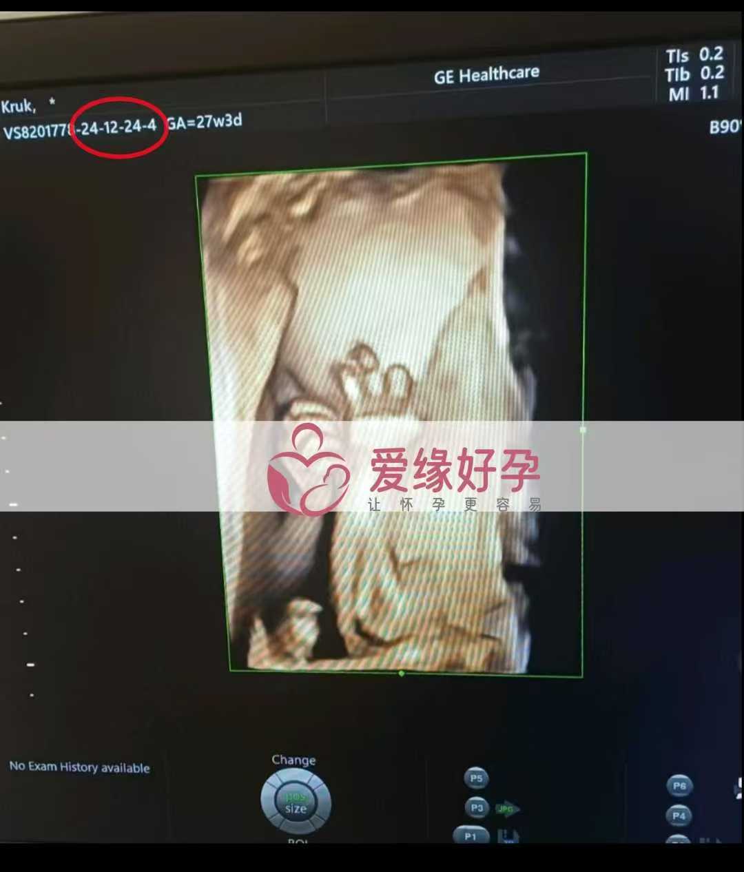 乌克兰代孕代母孕27周产检顺利通过