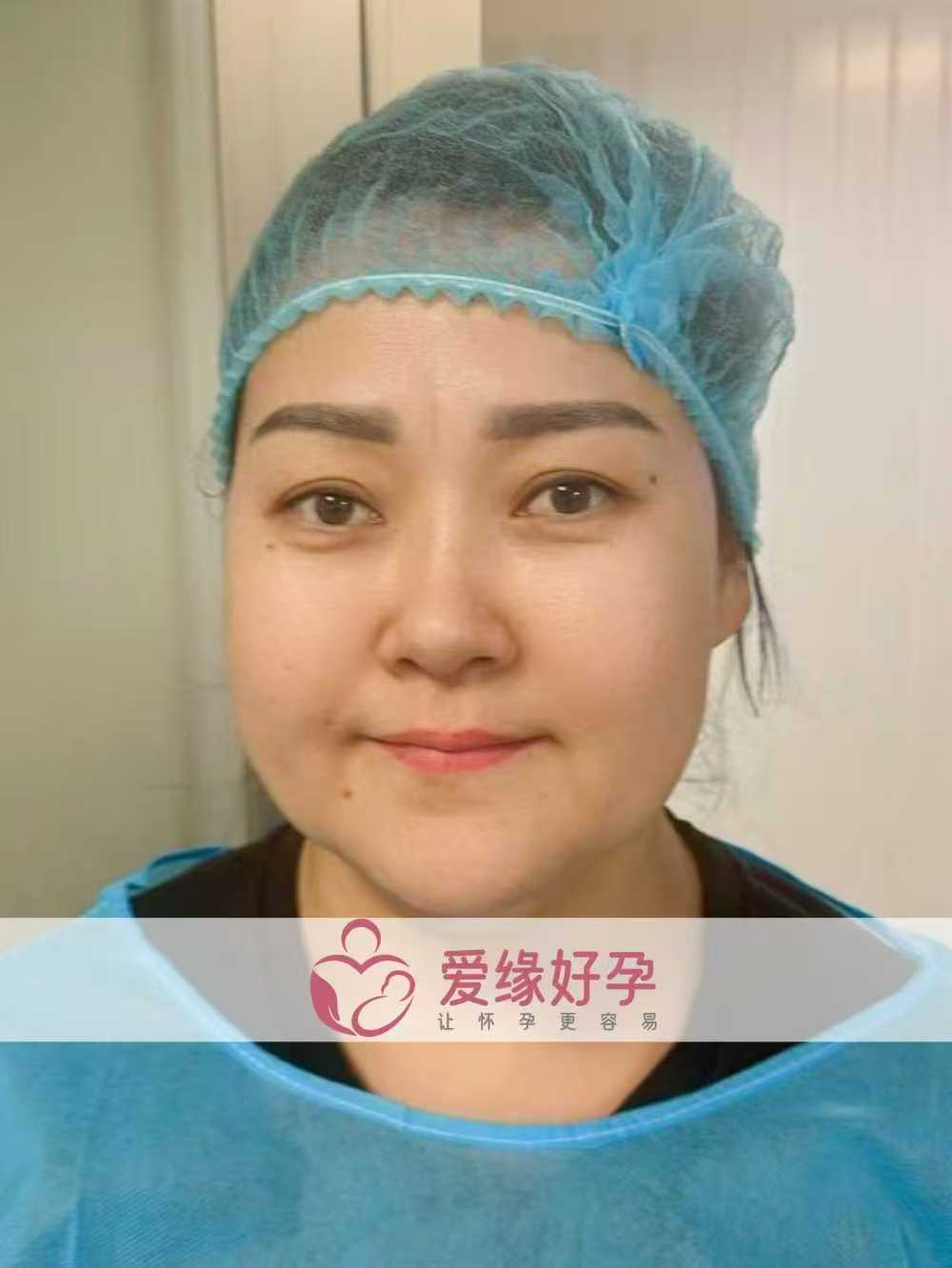 格鲁吉亚代孕代母顺利完成移植