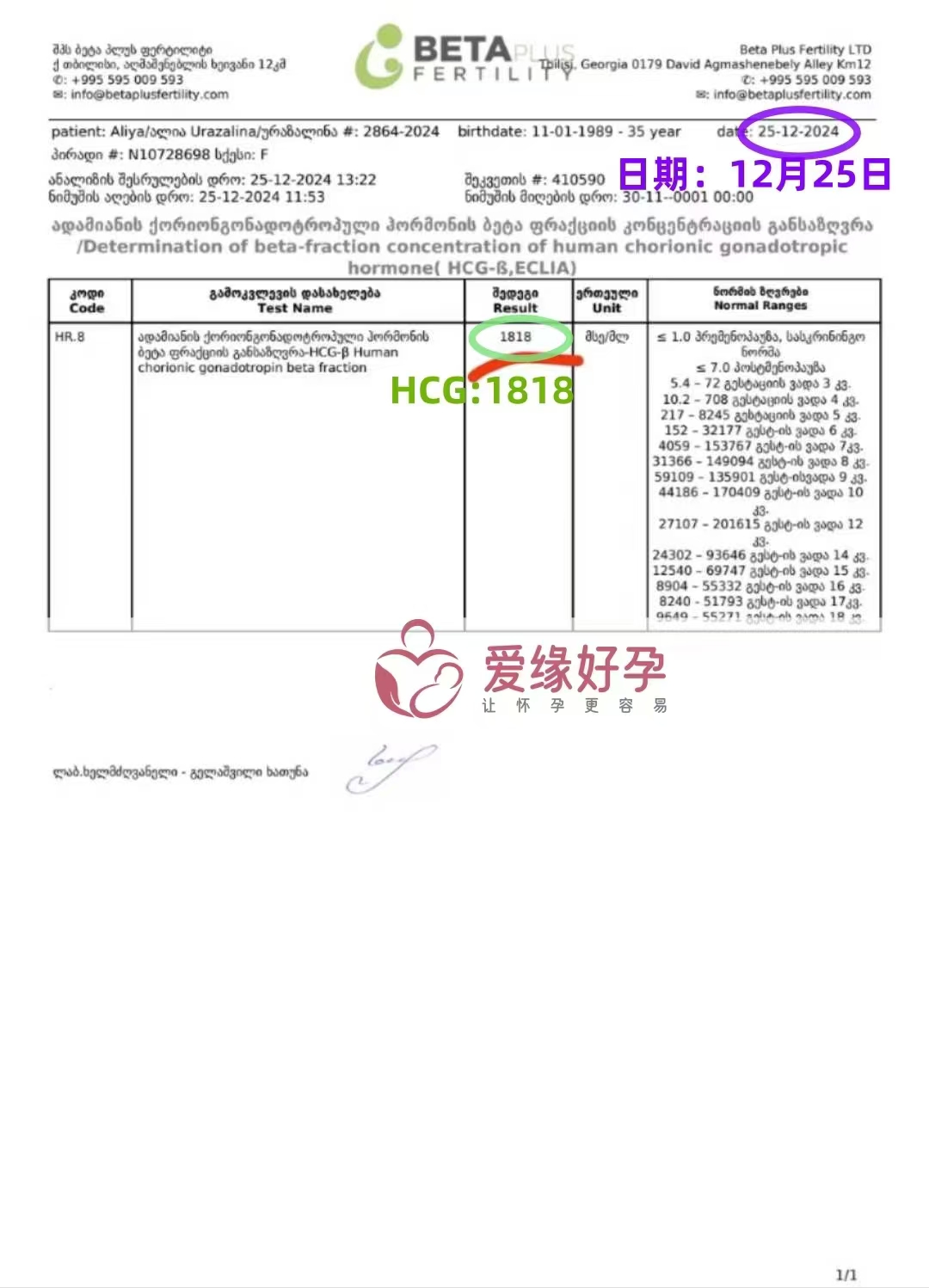 格鲁吉亚代孕代母验孕成功