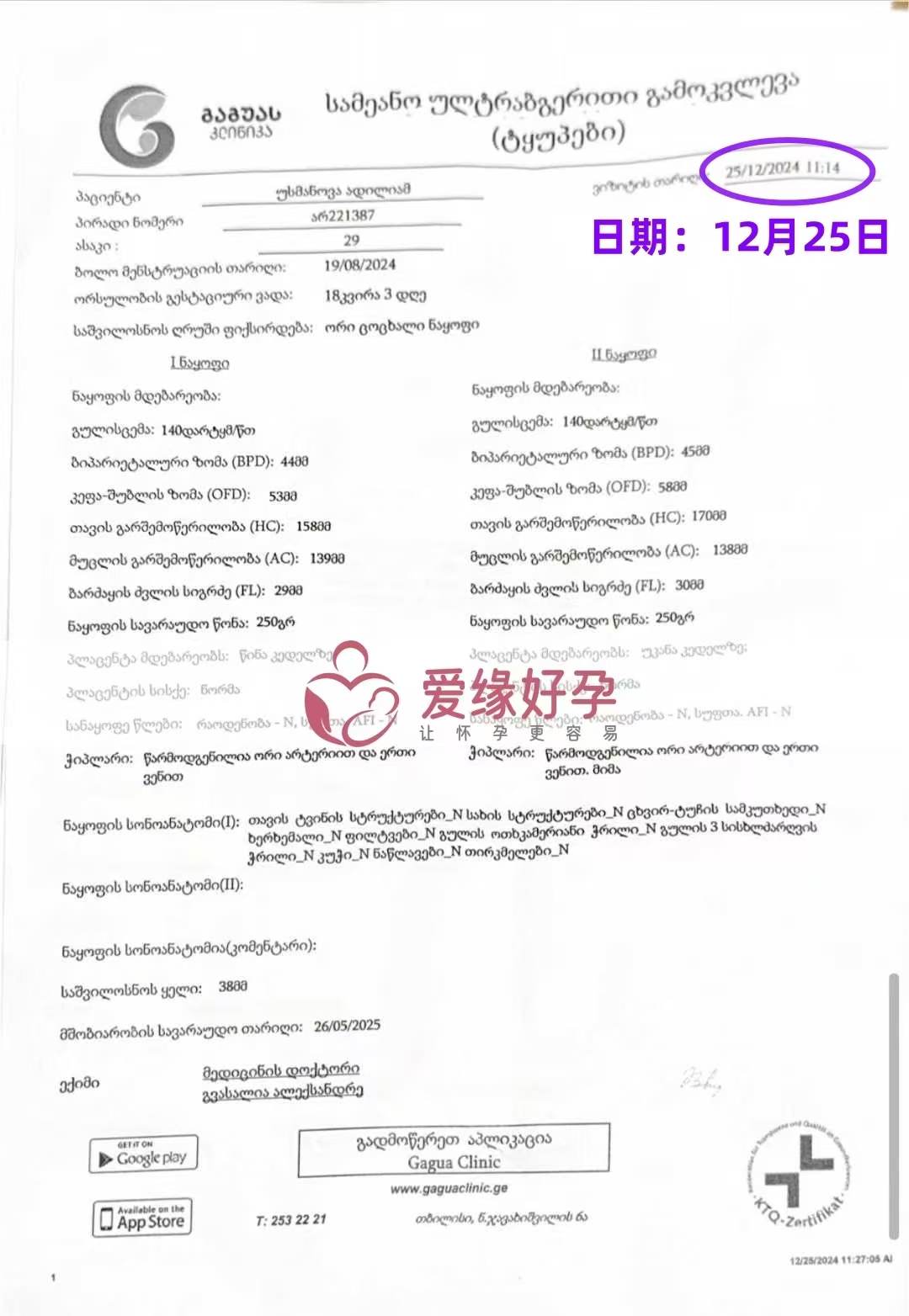 格鲁吉亚代孕代母孕18周产检顺利通过