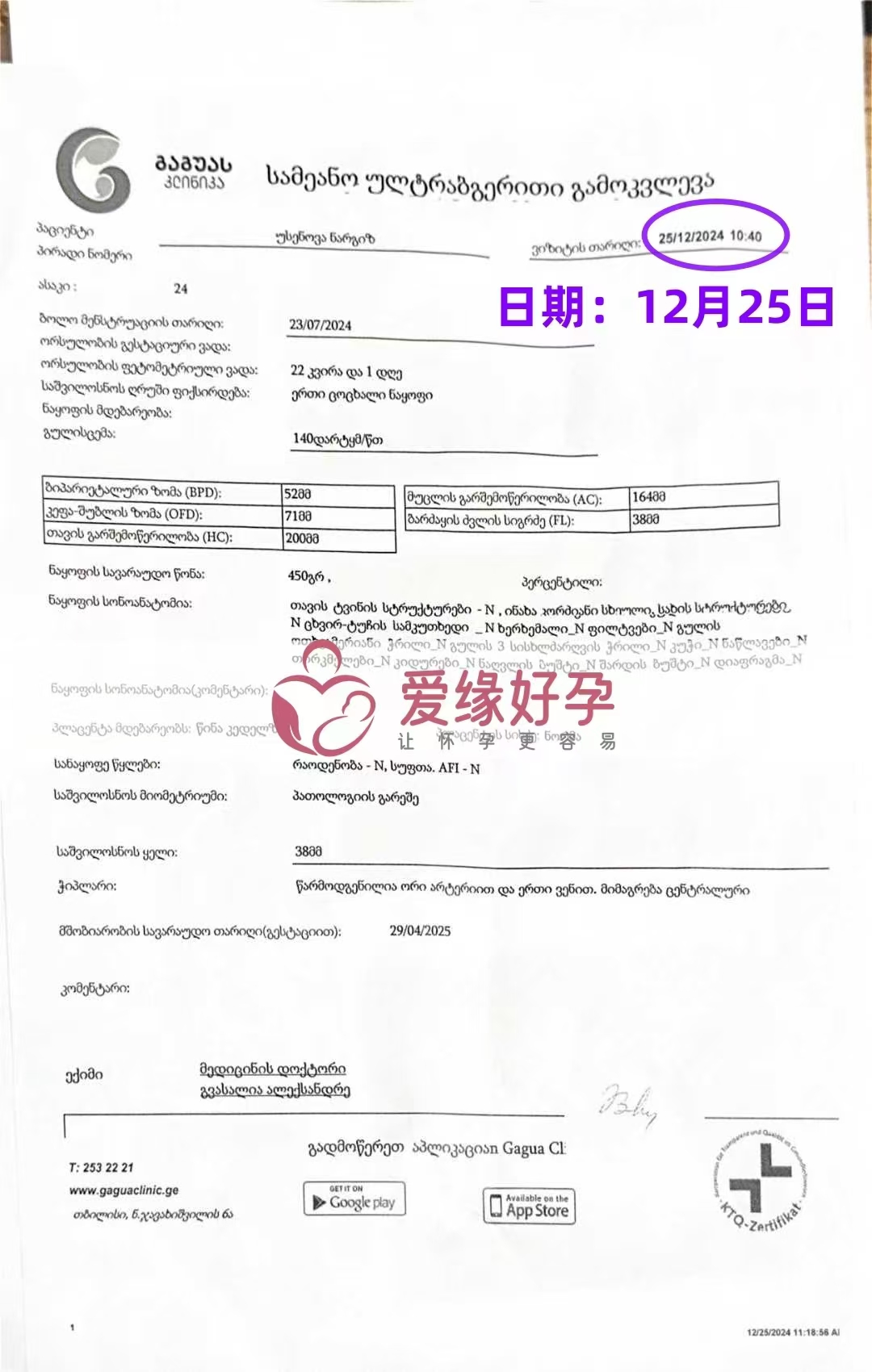 格鲁吉亚代孕代母孕21周大排畸产检顺利通过