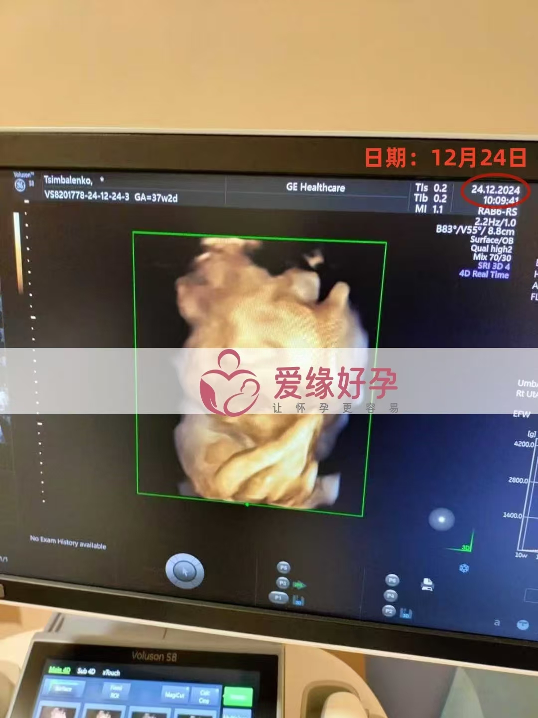 乌克兰代孕代母孕37周产检顺利通过