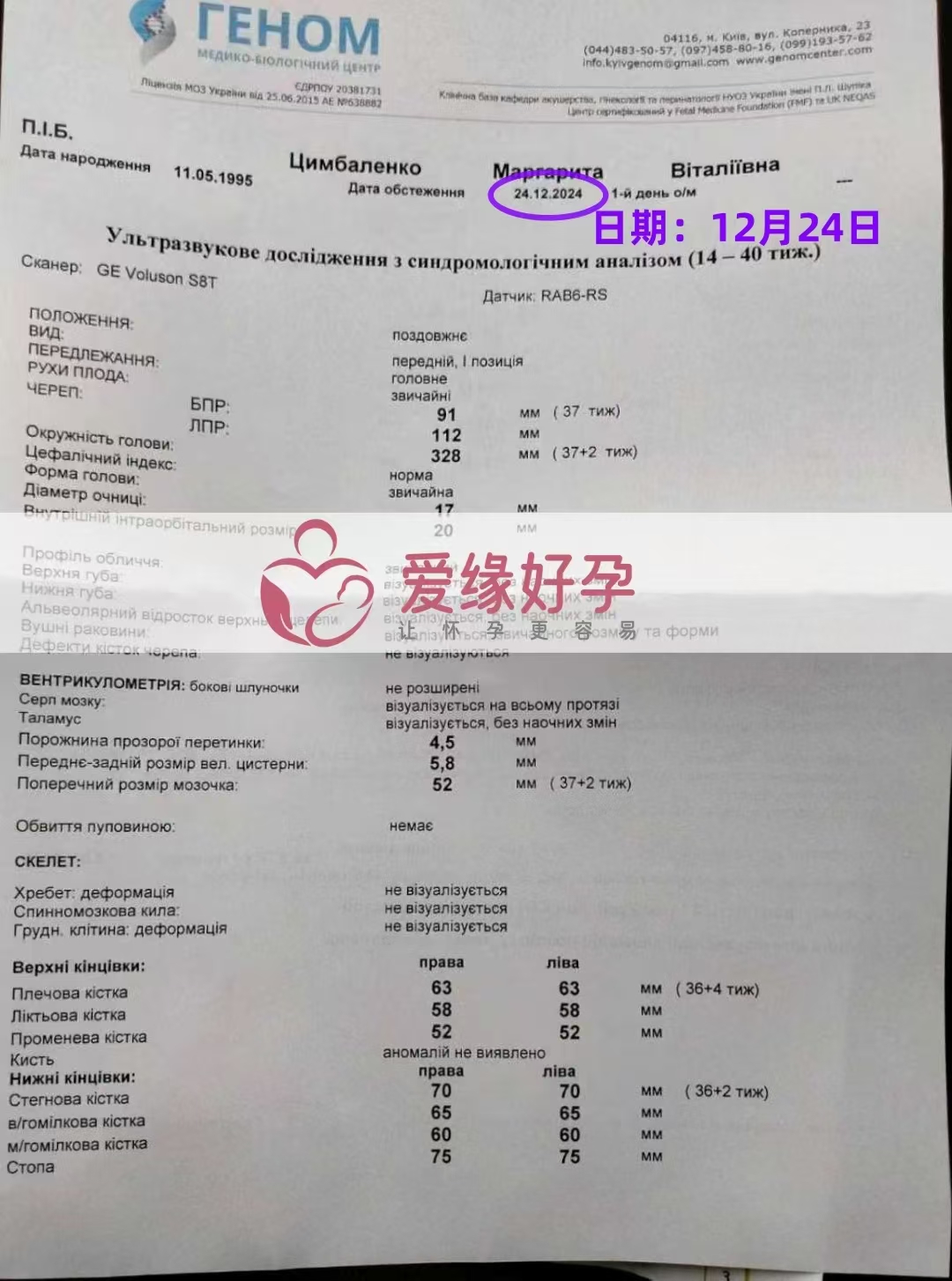 乌克兰代孕代母孕37周产检顺利通过