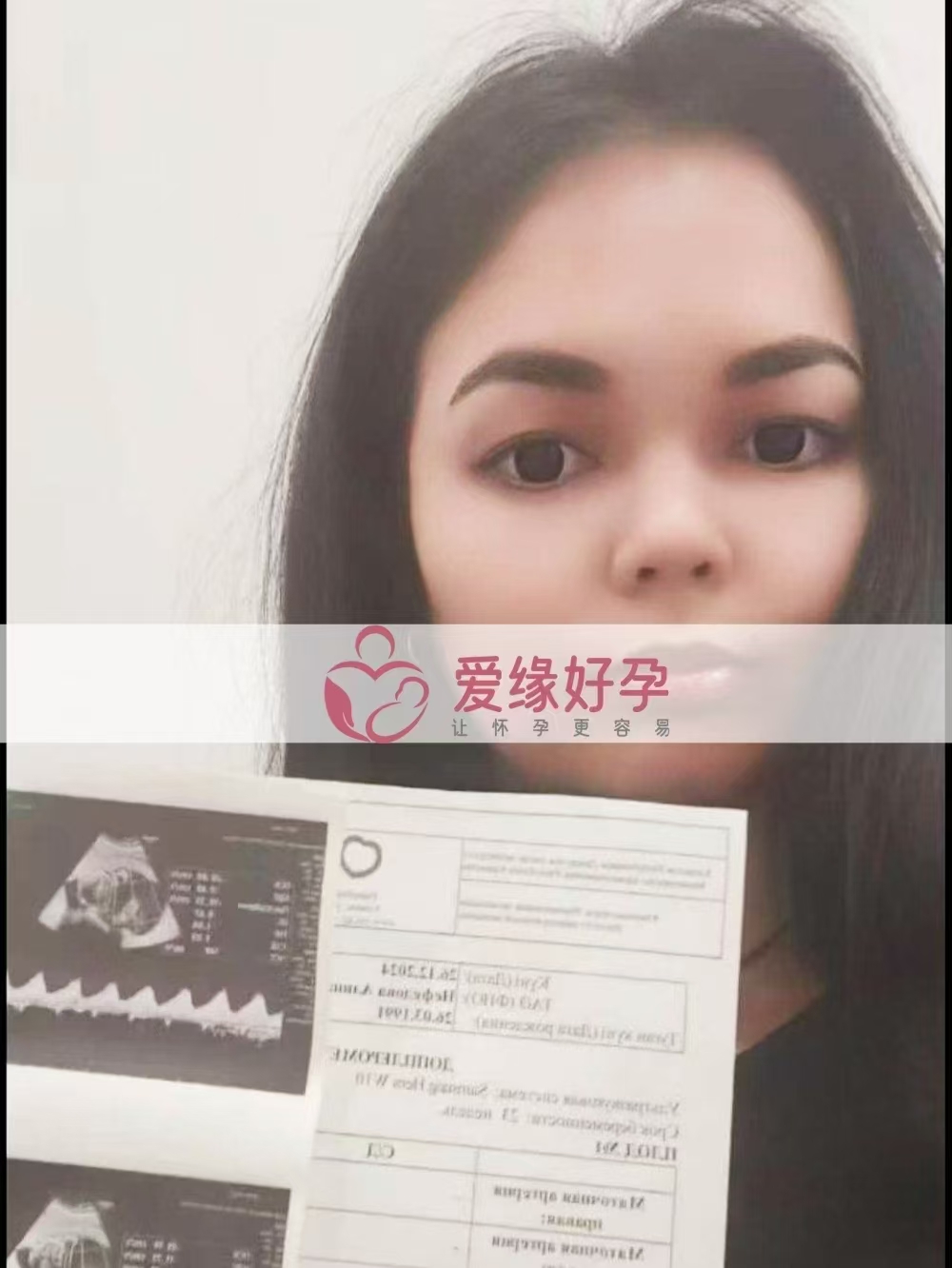 哈萨克斯坦代孕代母孕23周产检顺利通过