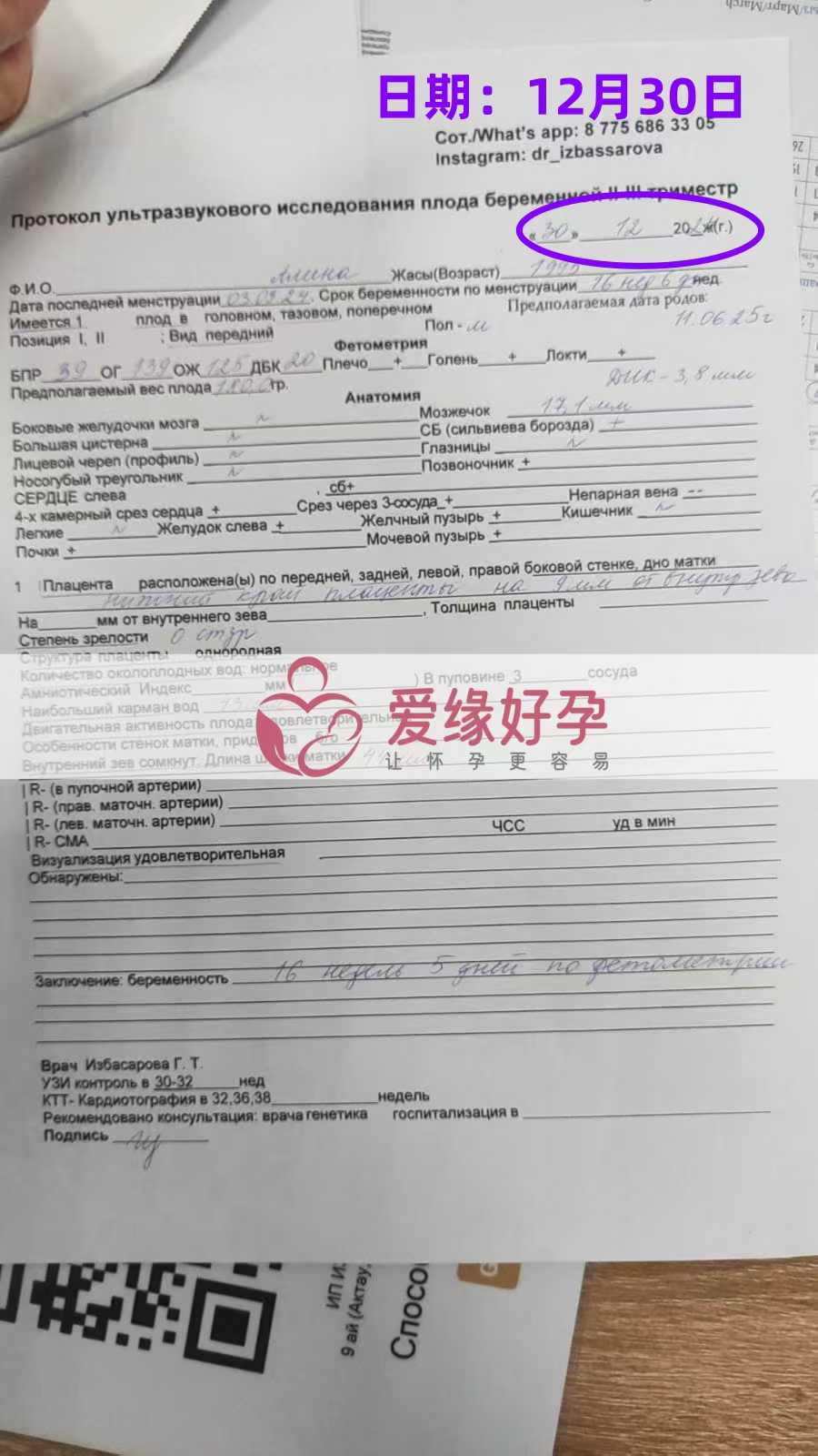 格鲁吉亚代孕代母孕16周产检顺利通过
