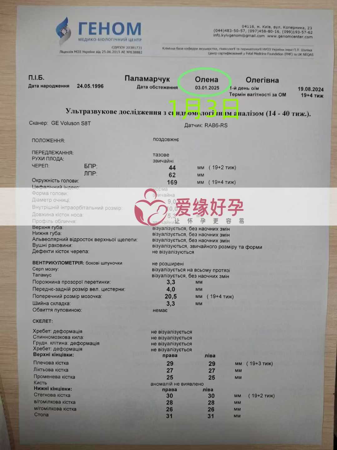 乌克兰代孕代母孕38周产检顺利通过