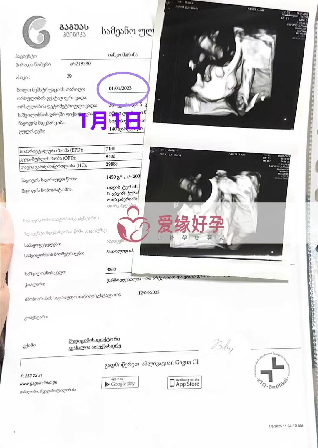 格鲁吉亚代孕代母孕30周产检顺利通过