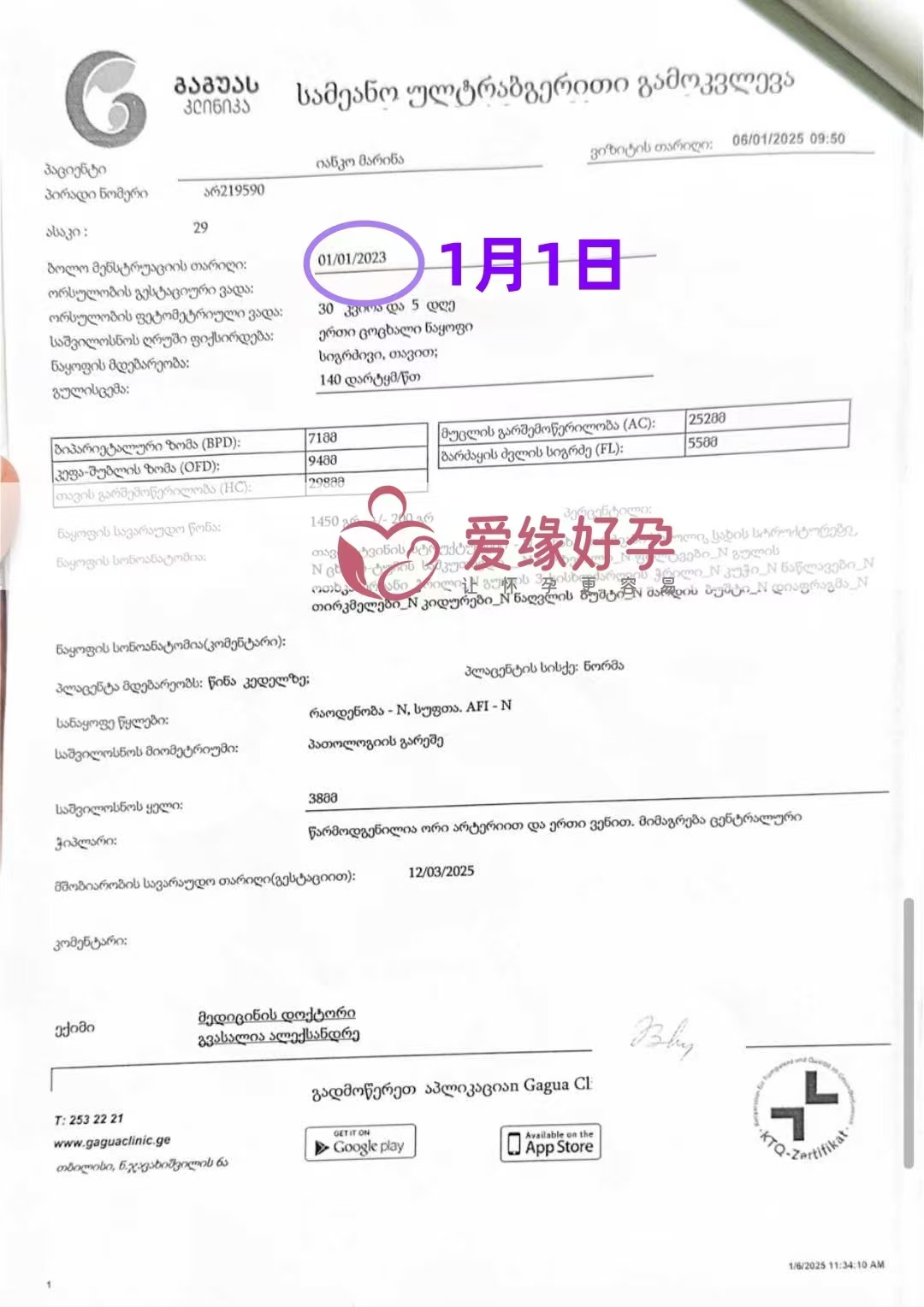 格鲁吉亚代孕代母孕30周产检顺利通过