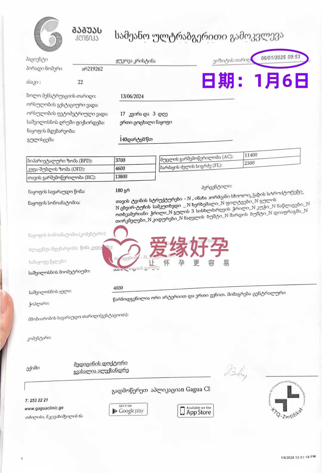格鲁吉亚代孕代母孕17周产检顺利通过