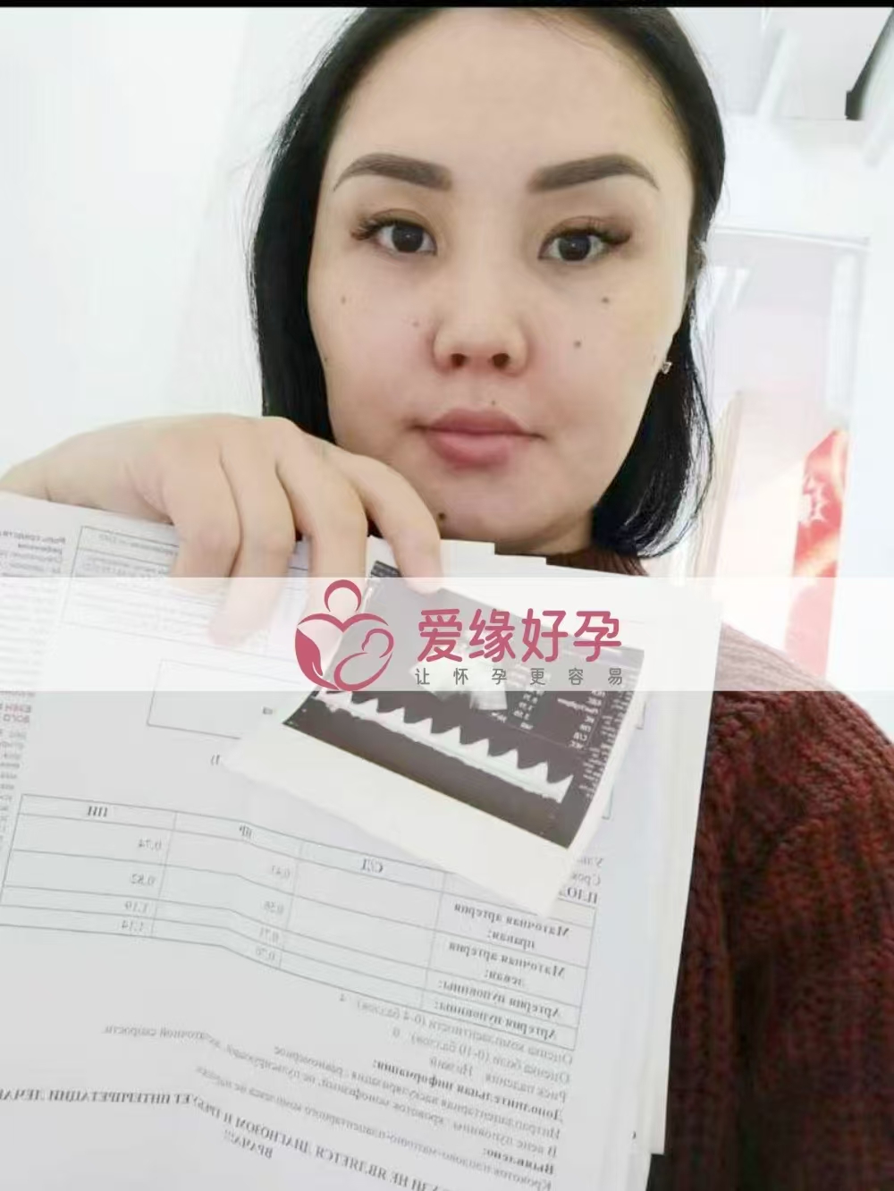 哈萨克斯坦代孕代母孕23周＋4天产检顺利通过
