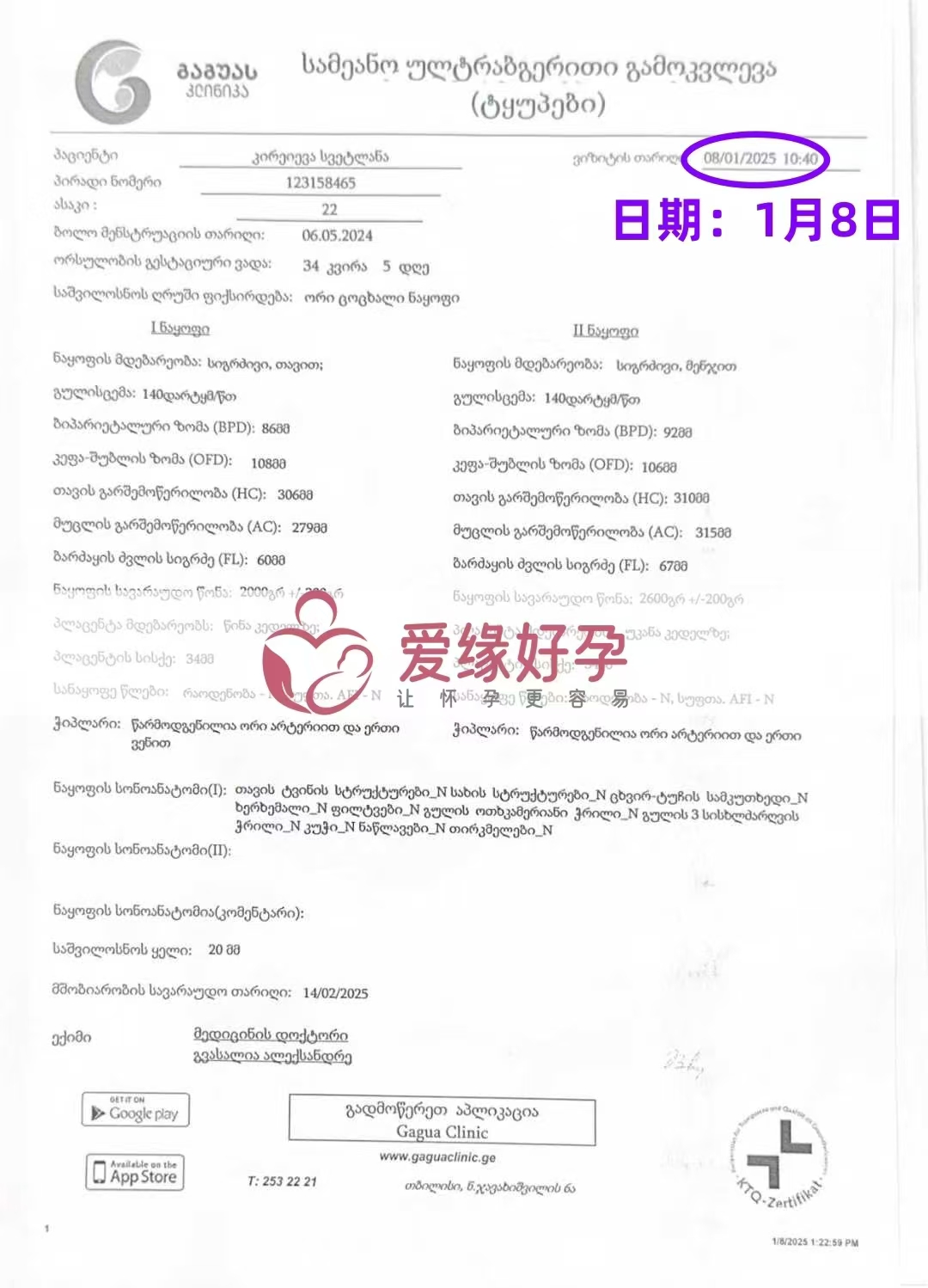 格鲁吉亚代孕代母孕34周＋5天产检顺利通过