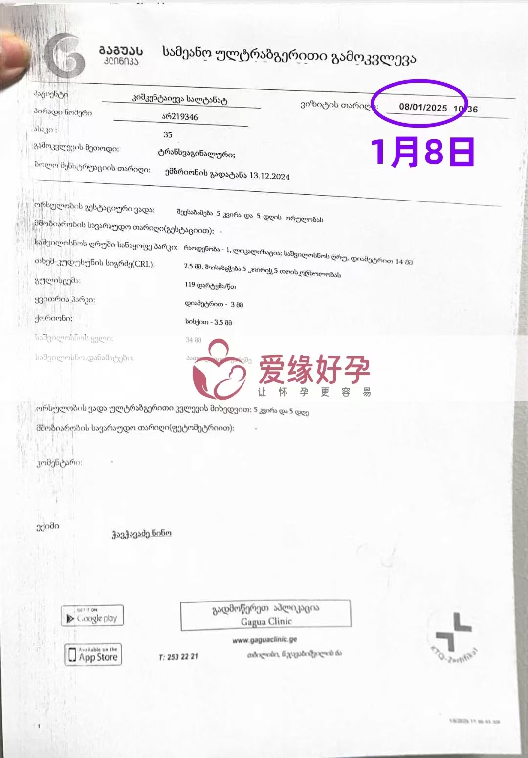 格鲁吉亚代孕代母孕5周＋5天产检顺利通过