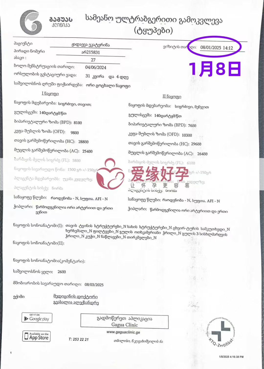 格鲁吉亚双胞胎代孕代母孕31周＋4天产检顺利通过