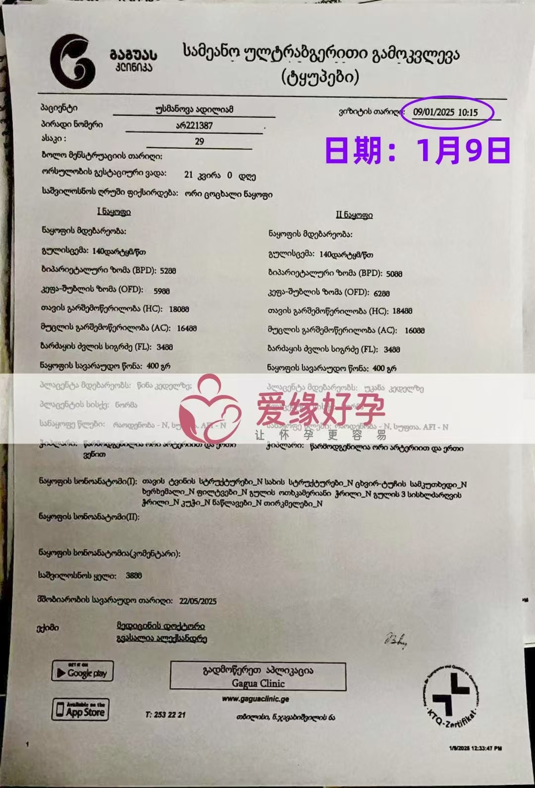 格鲁吉亚代孕代母孕21周产检顺利通过