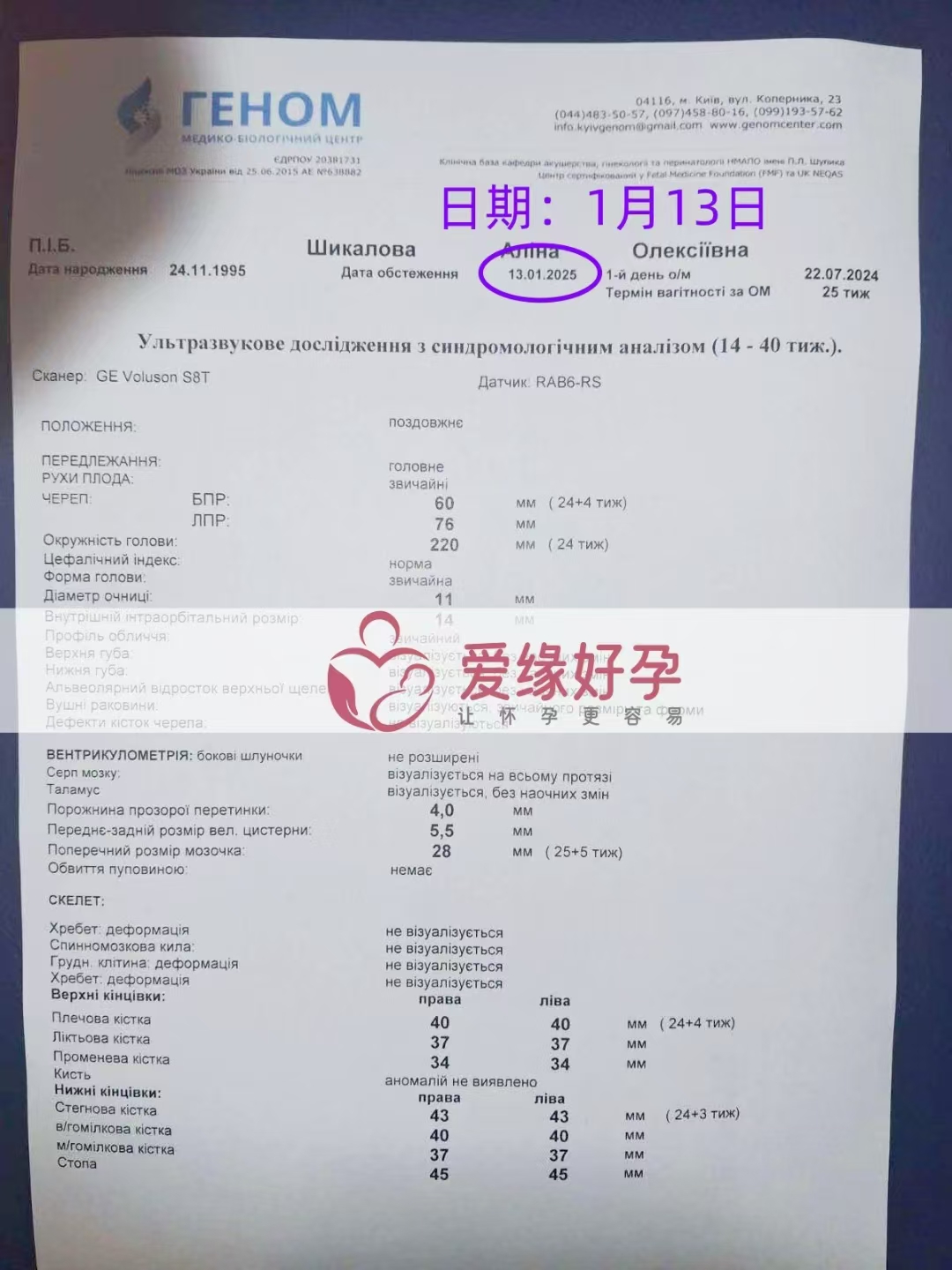 乌克兰代孕代母孕24周产检顺利通过