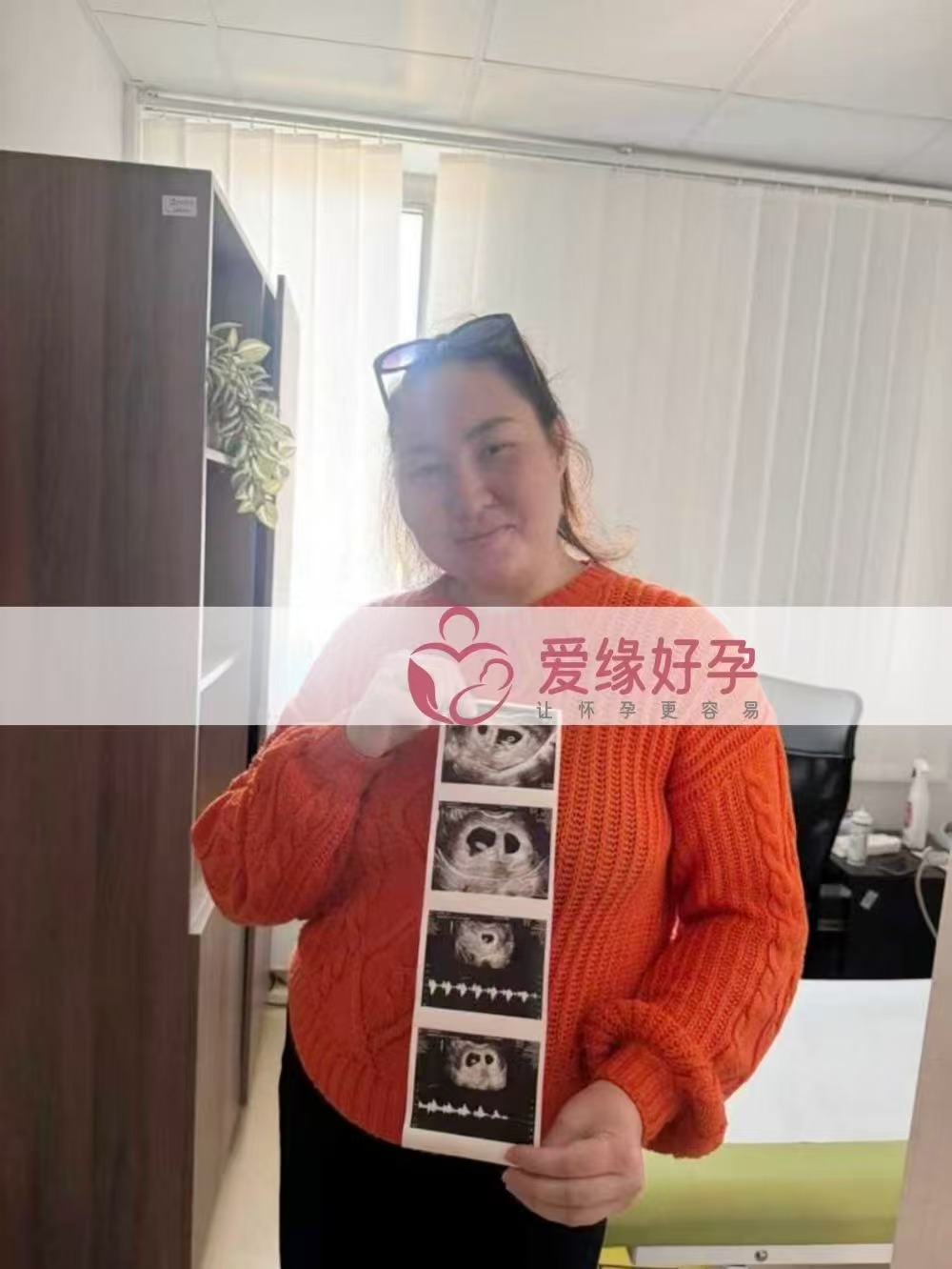 格鲁吉亚代孕代母第一次B超验孕双胎成功