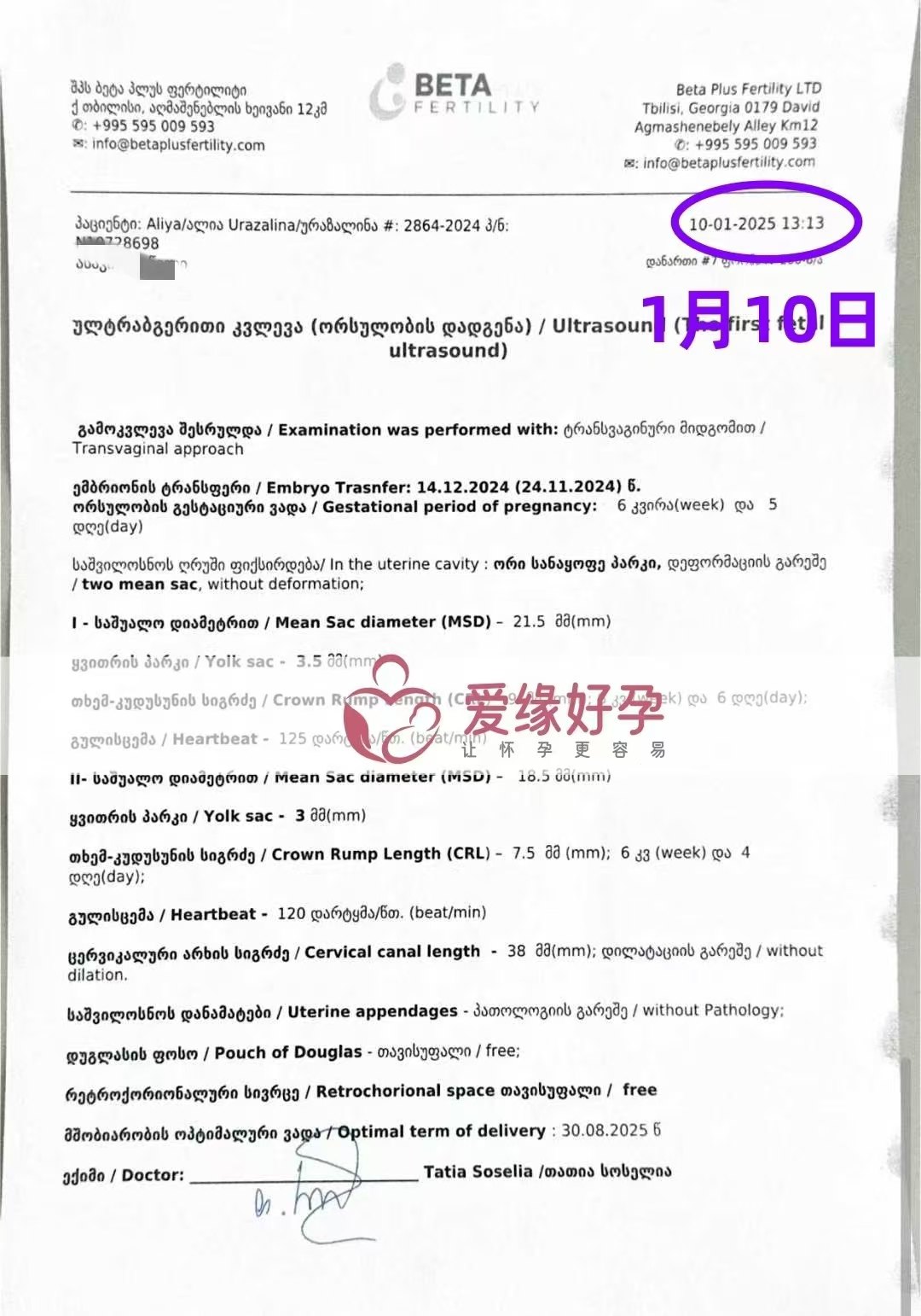 格鲁吉亚代孕代母第一次B超验孕双胎成功