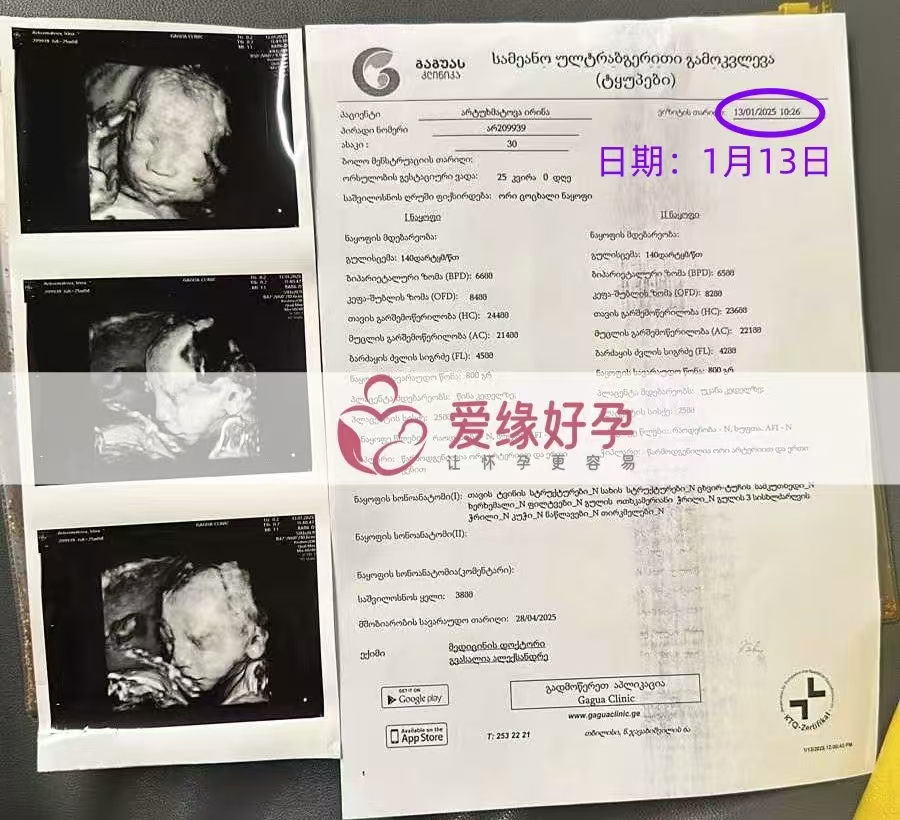 格鲁吉亚代孕代母孕25周产检顺利通过