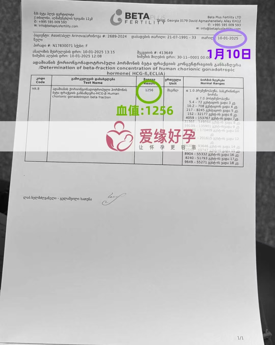 格鲁吉亚代孕代母验孕成功