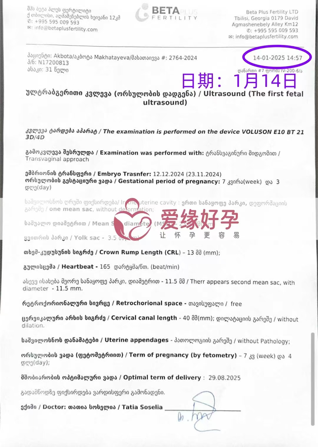 格鲁吉亚代孕代母孕7周产检顺利通过