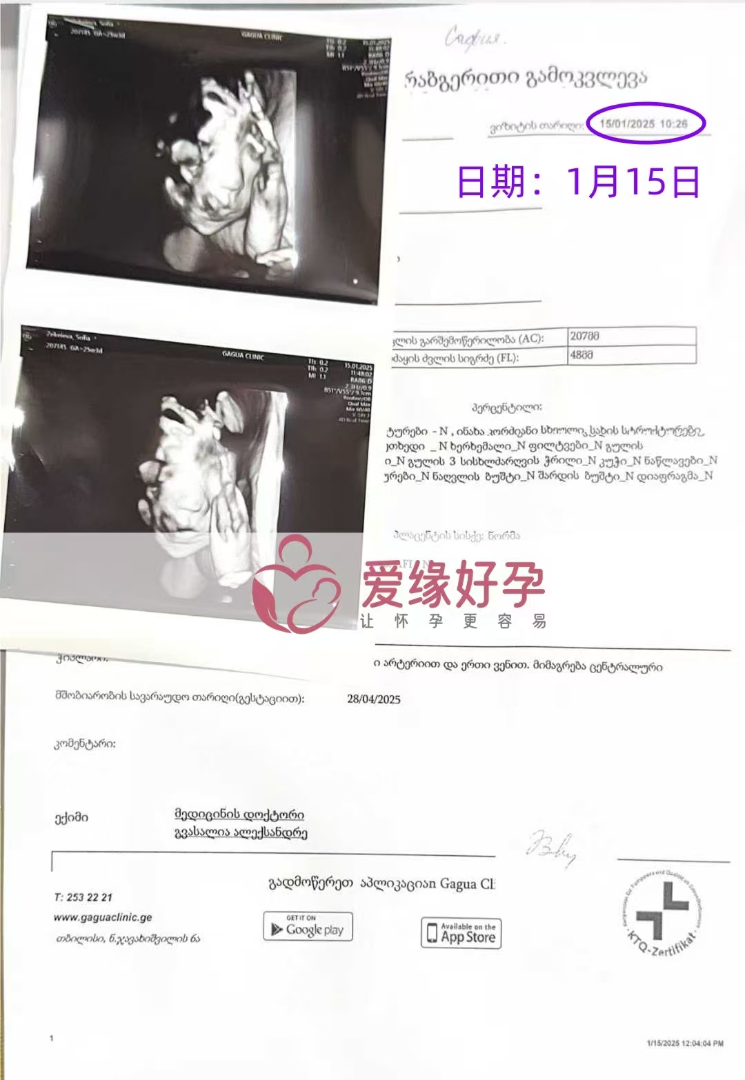 格鲁吉亚代孕代母孕25周产检顺利通过