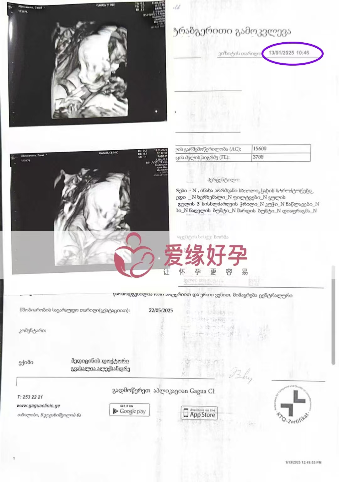 格鲁吉亚代孕代母孕21周产检顺利通过