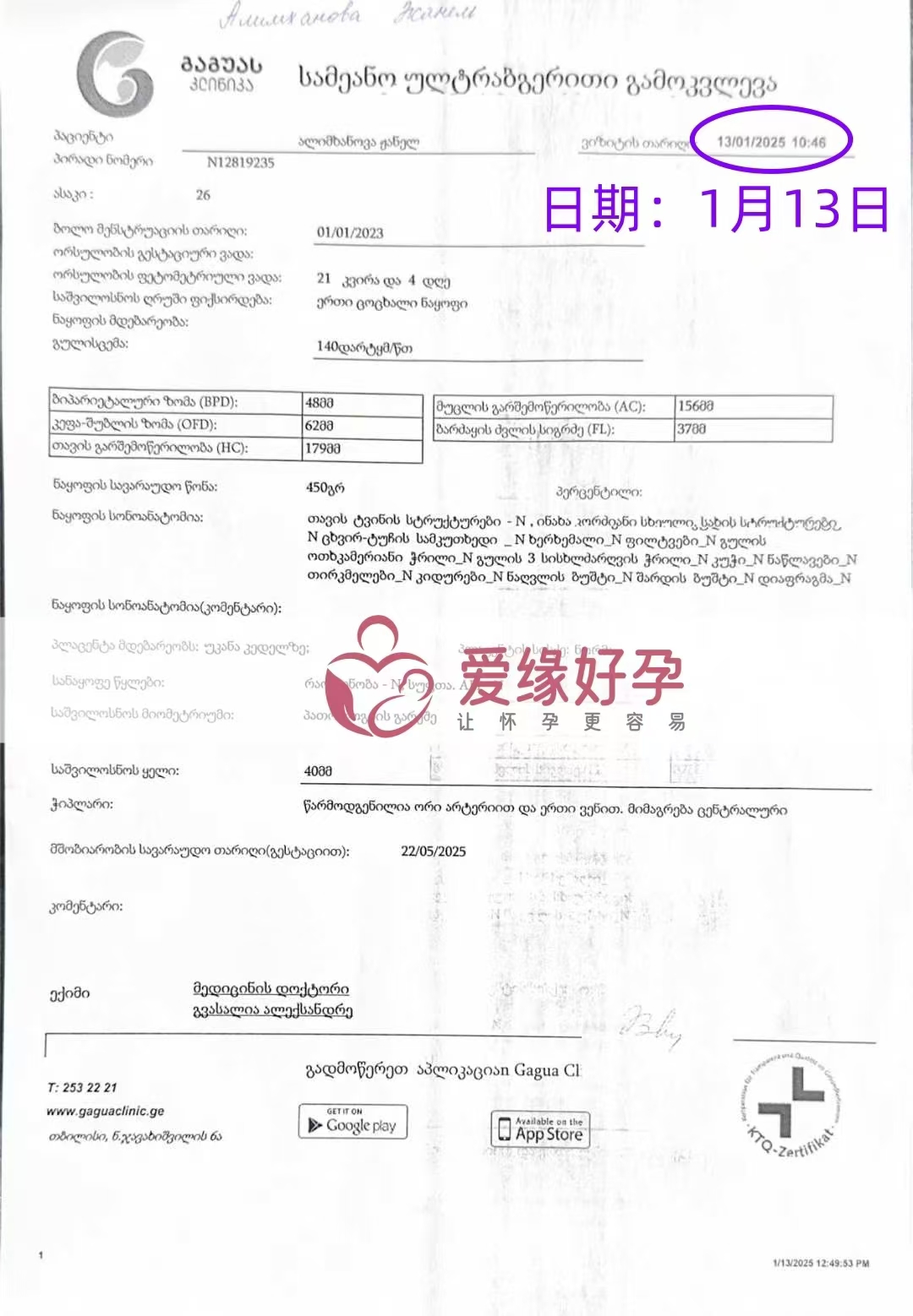 格鲁吉亚代孕代母孕21周产检顺利通过