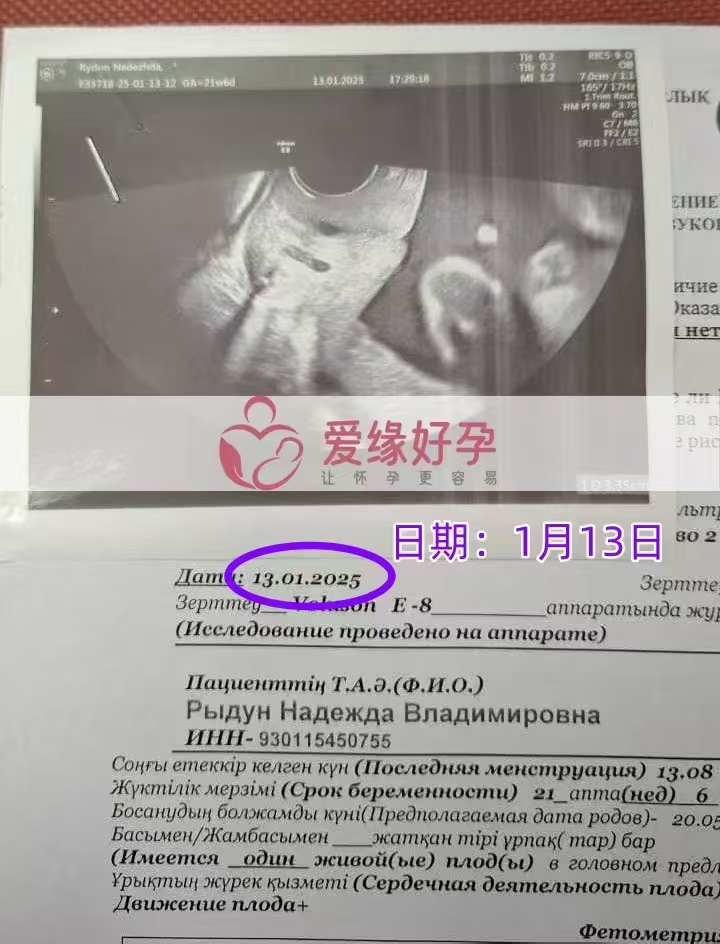格鲁吉亚代孕代母孕21周产检顺利通过