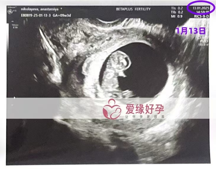 格鲁吉亚代孕代母孕9周产检顺利通过