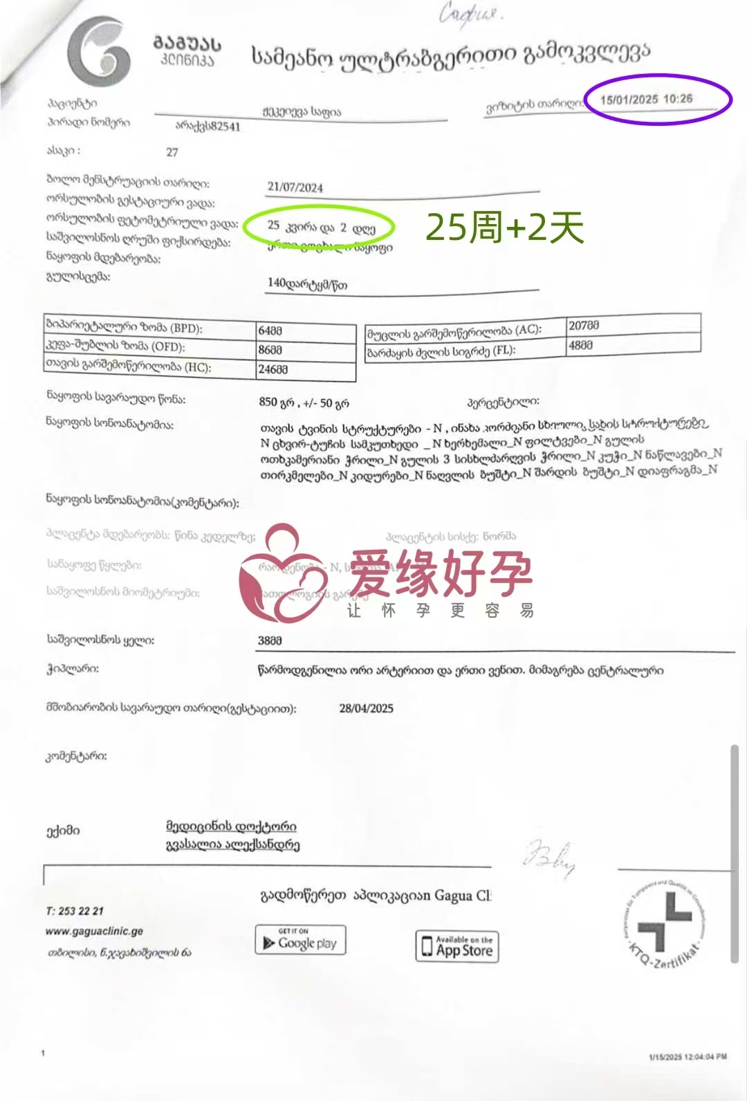 格鲁吉亚代孕代母孕25周产检顺利通过
