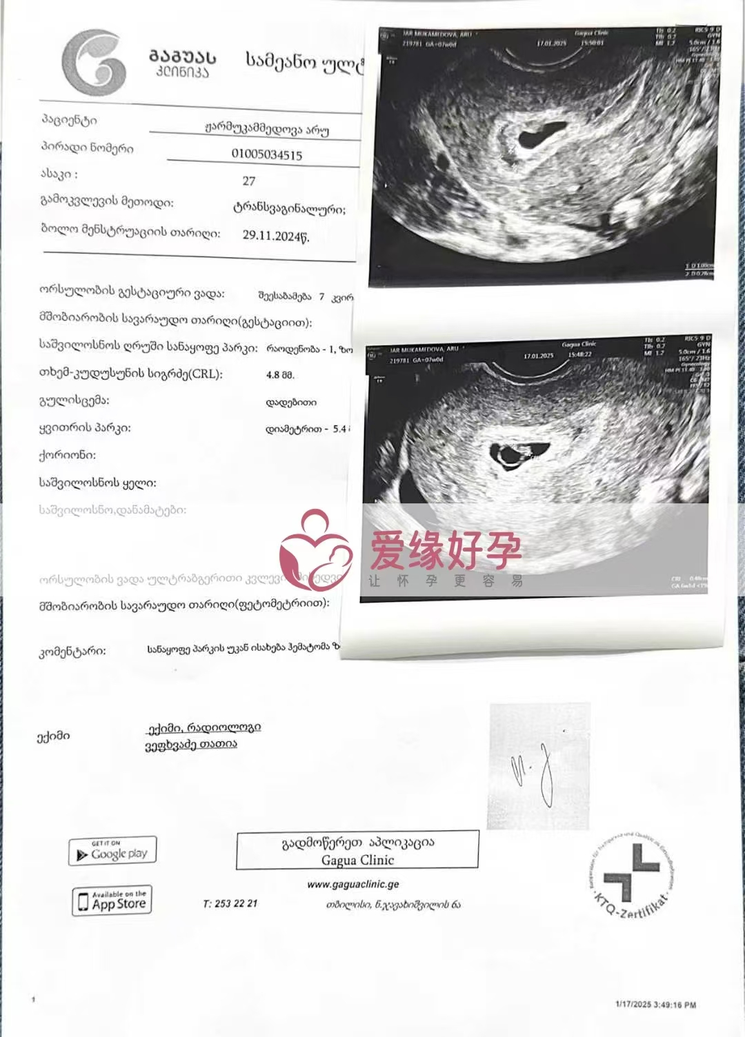 格鲁吉亚代孕代母孕7周产检顺利通过