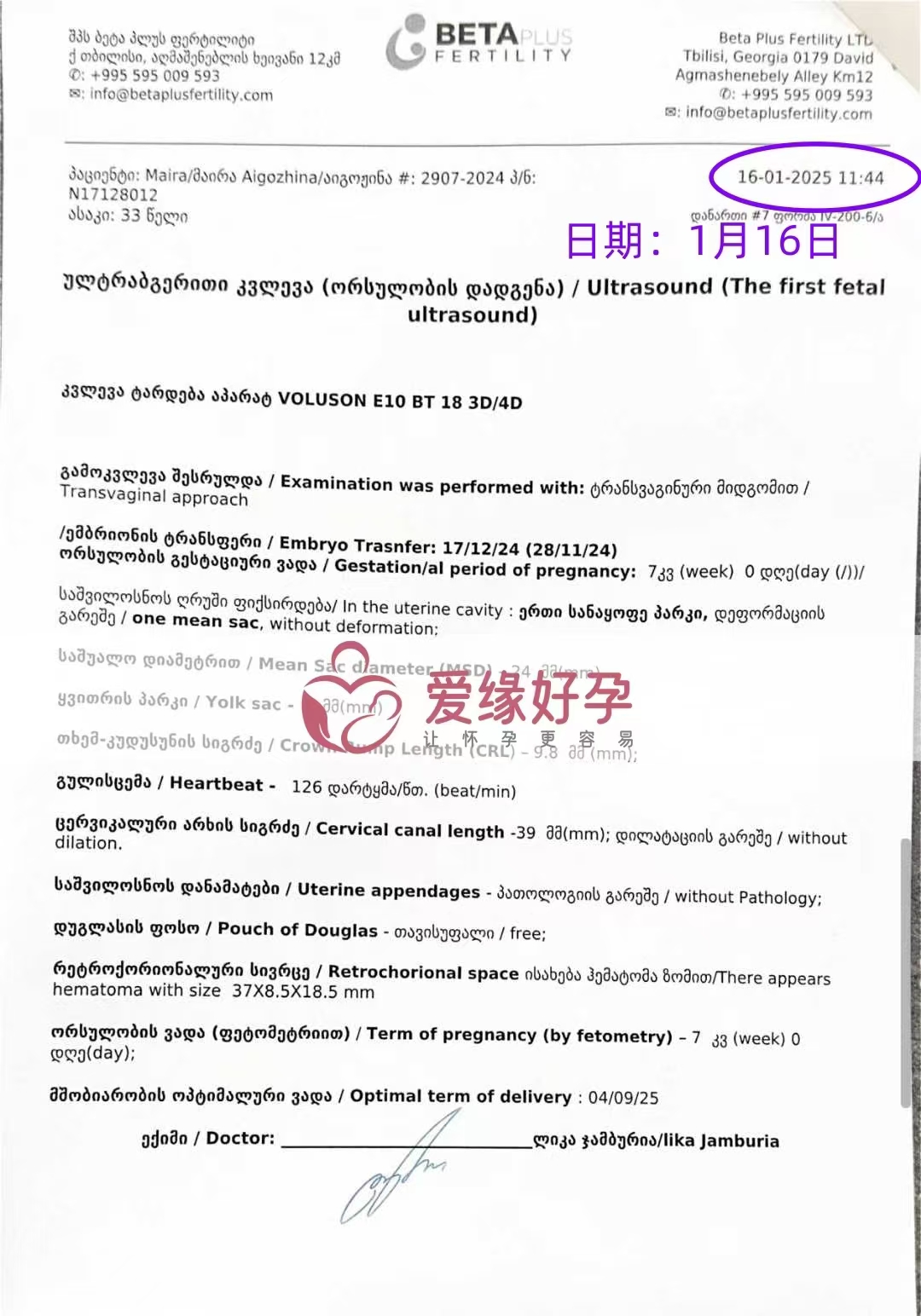 格鲁吉亚代孕代母孕7周产检顺利通过