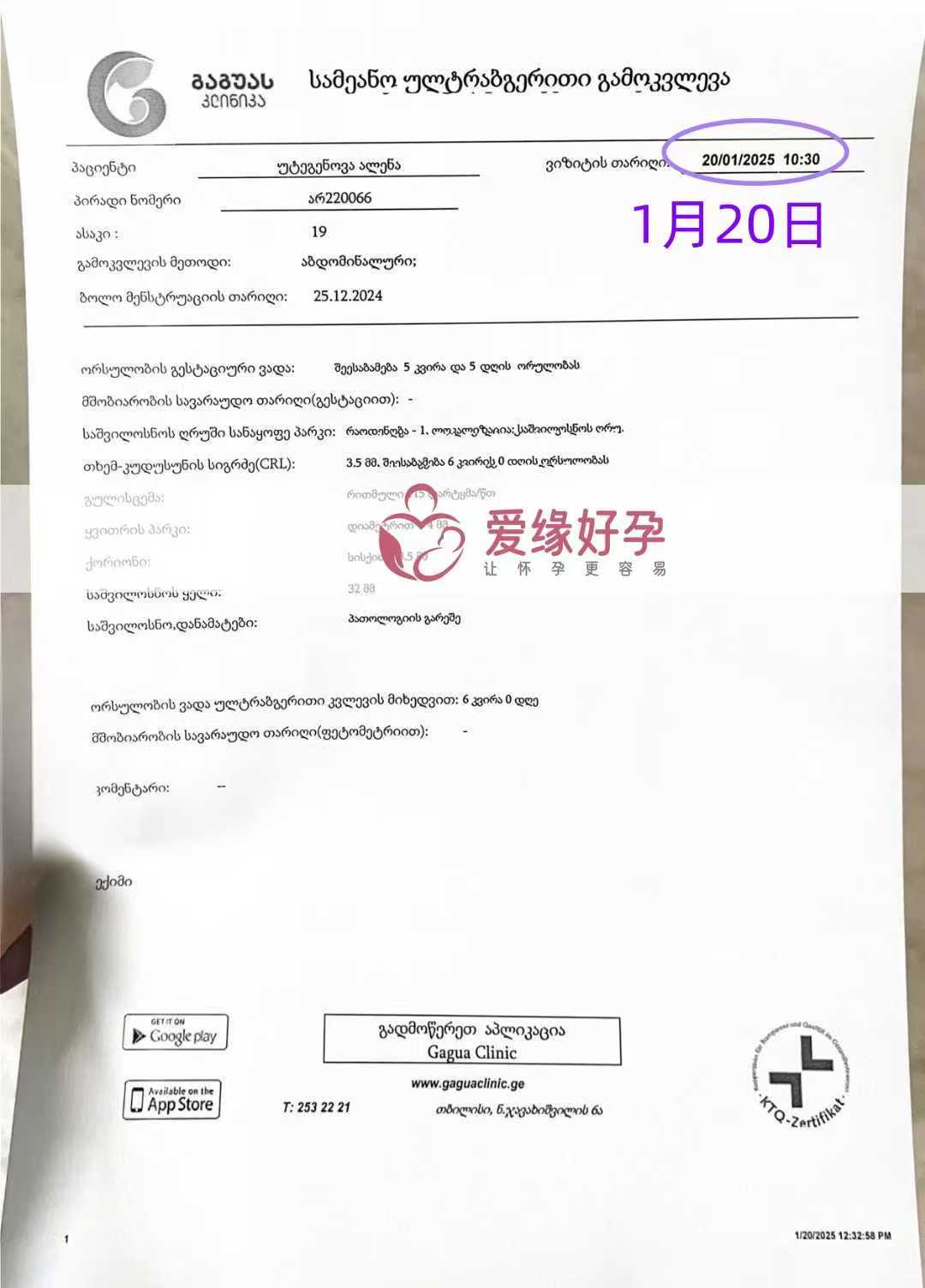 格鲁吉亚代孕代母孕5周产检顺利通过