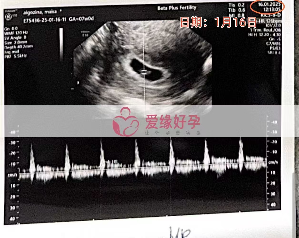 格鲁吉亚代孕代母孕7周产检顺利通过