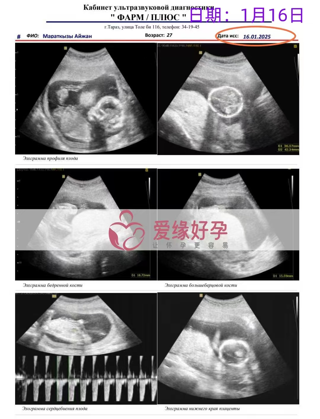 格鲁吉亚代孕代母孕16周产检顺利通过