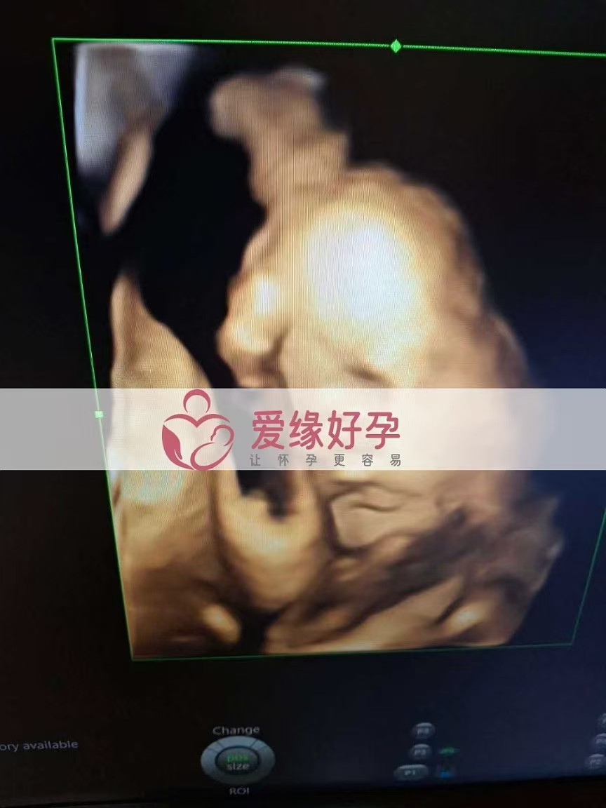 乌克兰代孕代母孕31周产检顺利通过