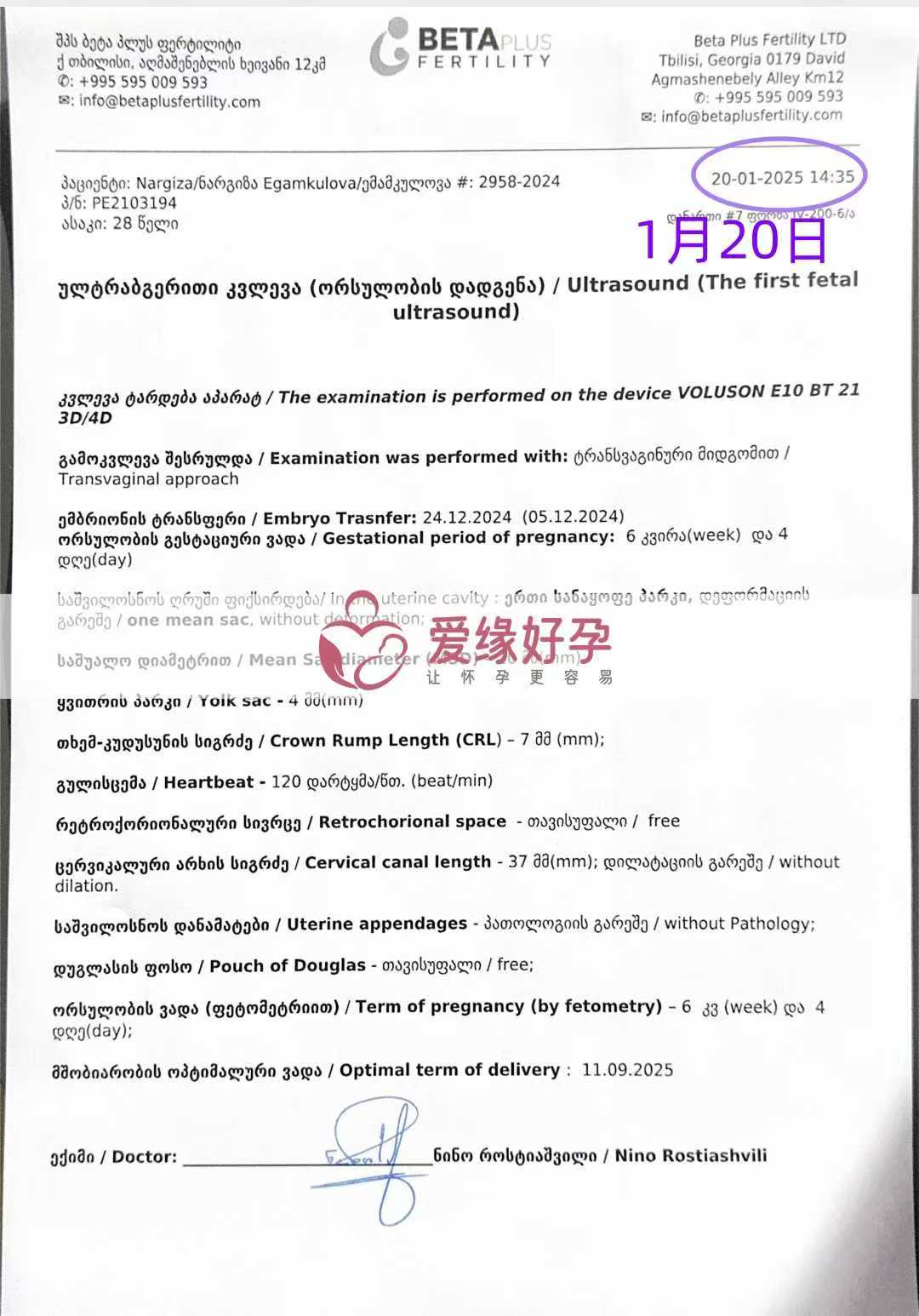 格鲁吉亚代孕代母第一次B超产检顺利通过