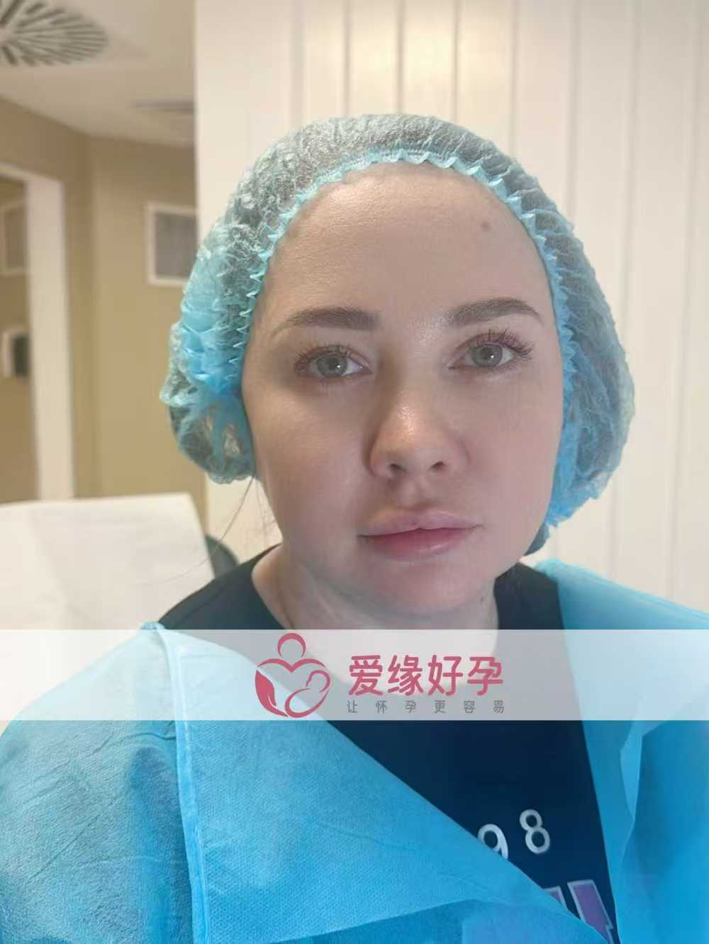格鲁吉亚代孕代母顺利移植一男一女双胞胎