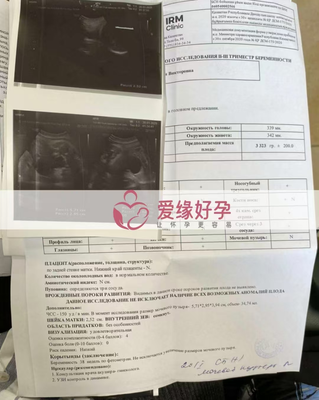 哈萨克斯坦代孕代母孕38周产检顺利通过
