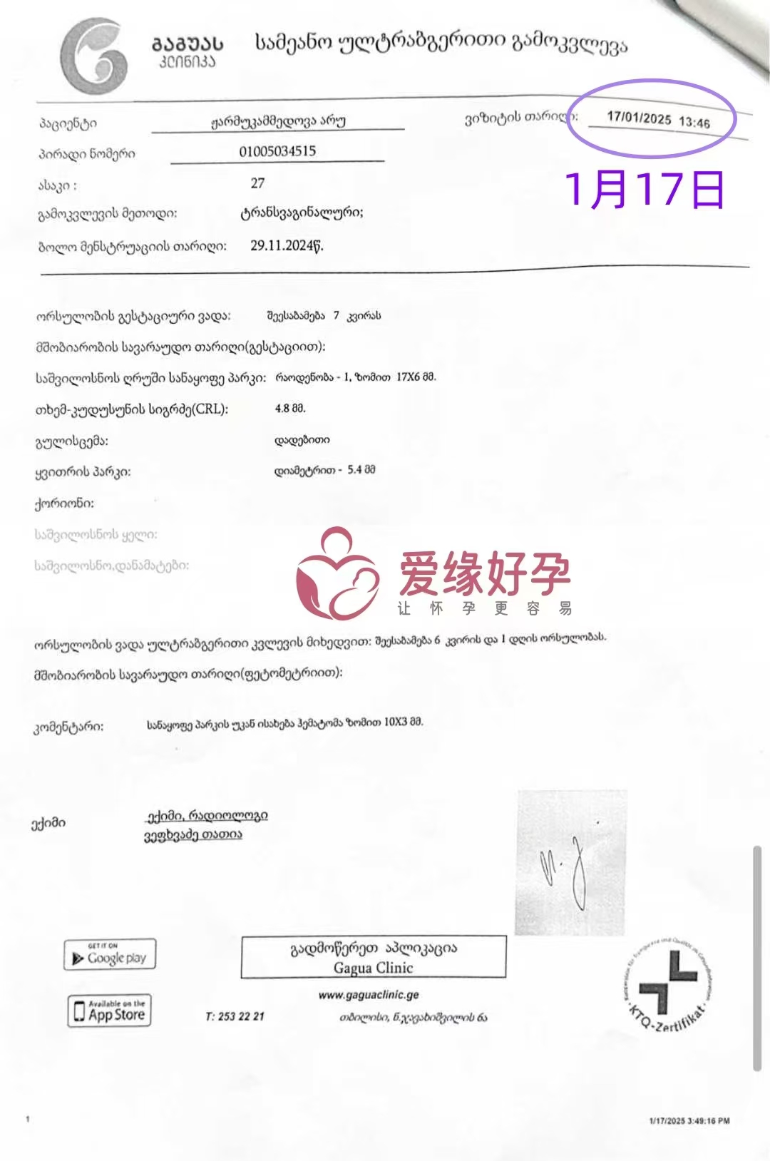 格鲁吉亚代孕代母孕7周产检顺利通过