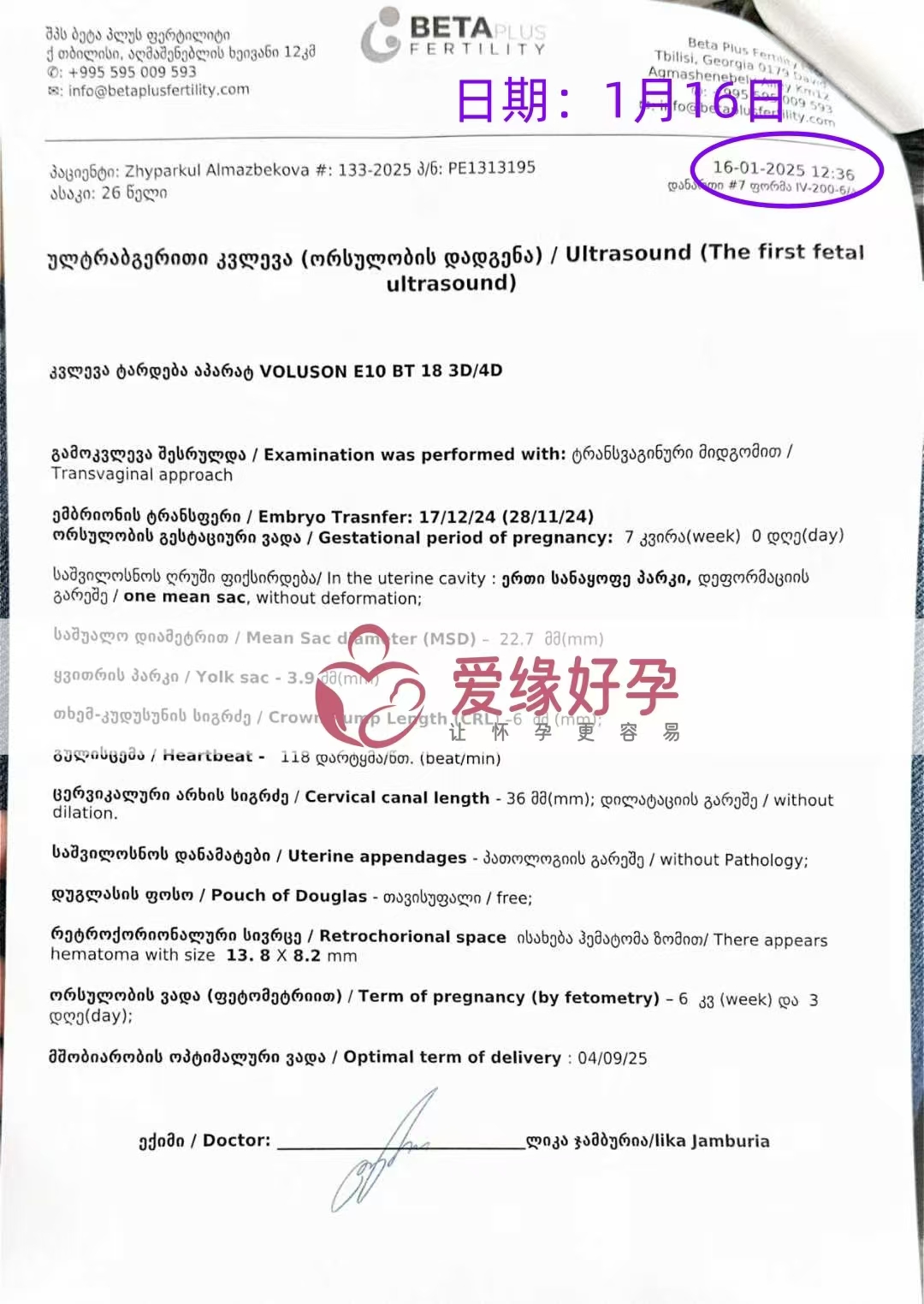 格鲁吉亚代孕代母第一次B超顺利通过