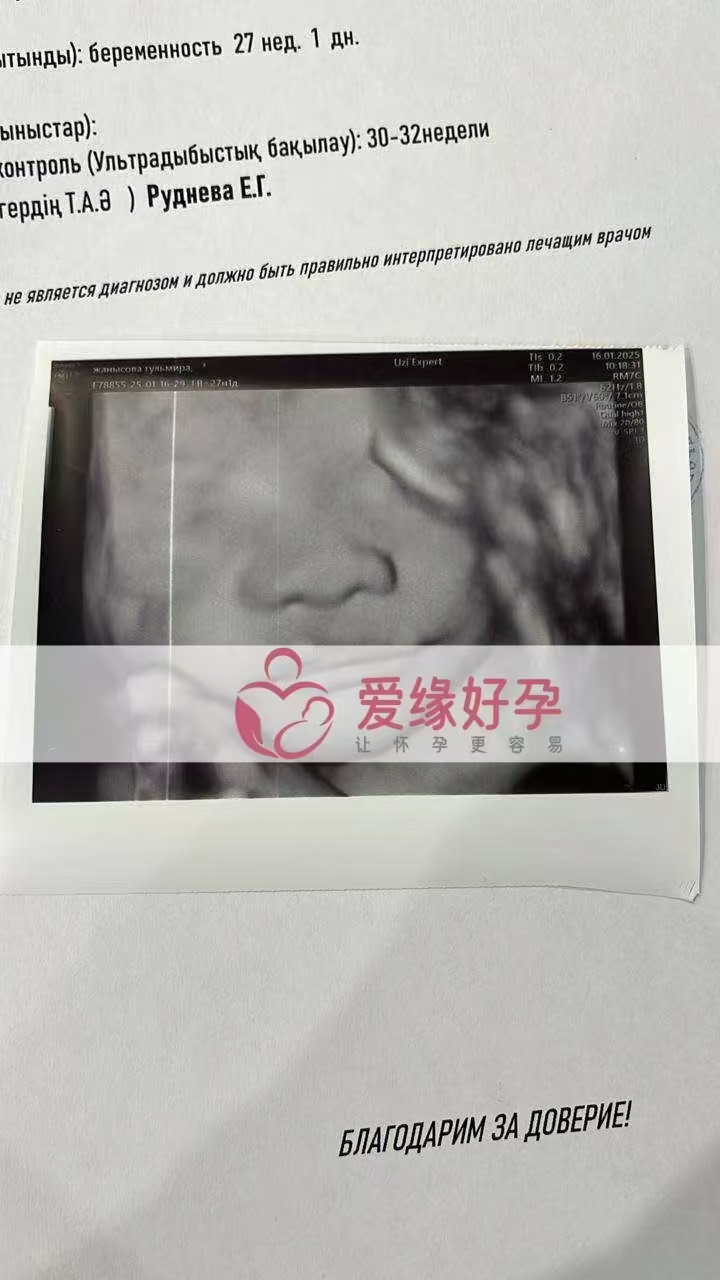 哈萨克斯坦代孕代母孕27周产检顺利通过