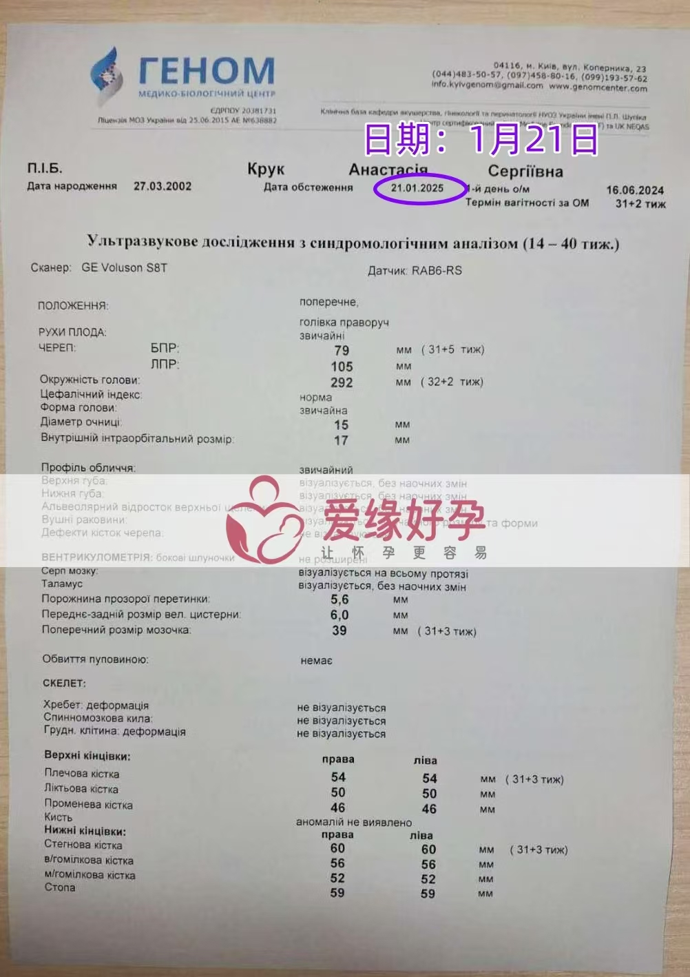 乌克兰代孕代母孕31周产检顺利通过